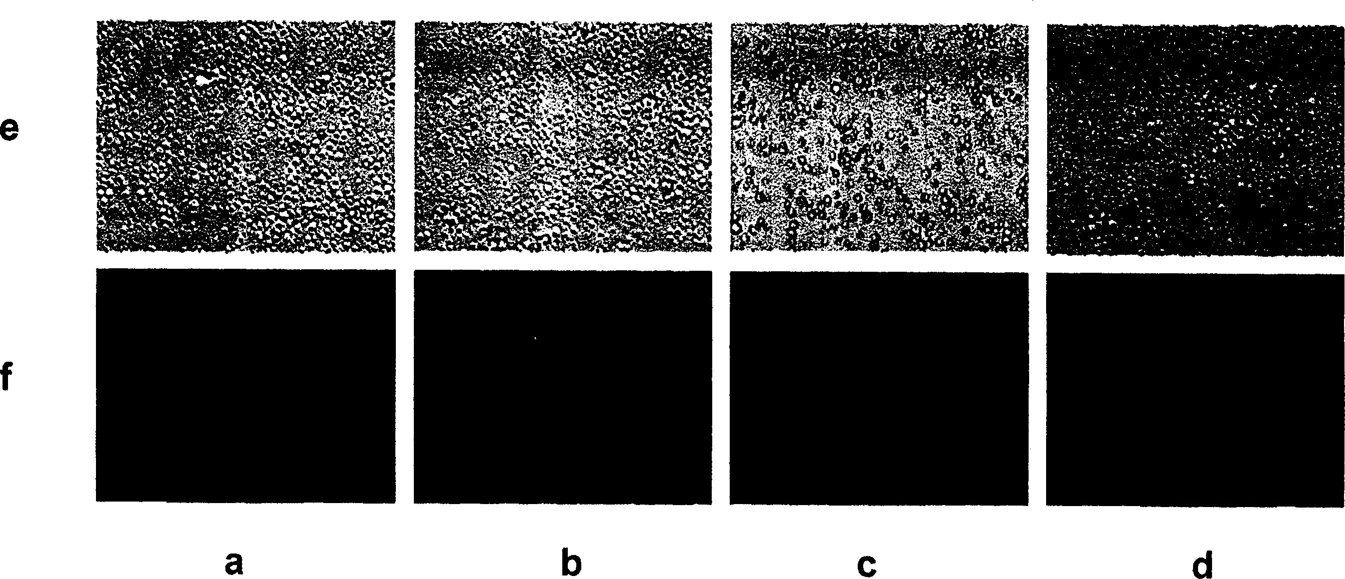 Anti EB virus resulted tumour polypeptide, and its use and preparing method