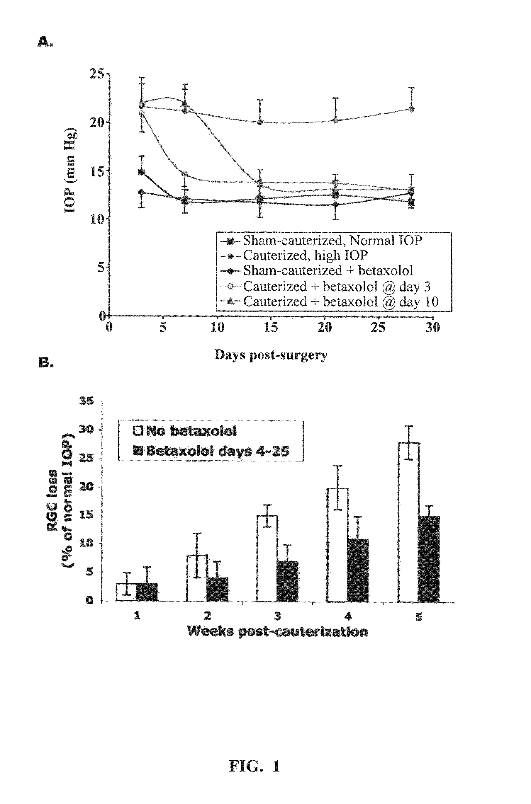 Treatment of ocular disease with inhibitors of alpha2 macroglobulin protein