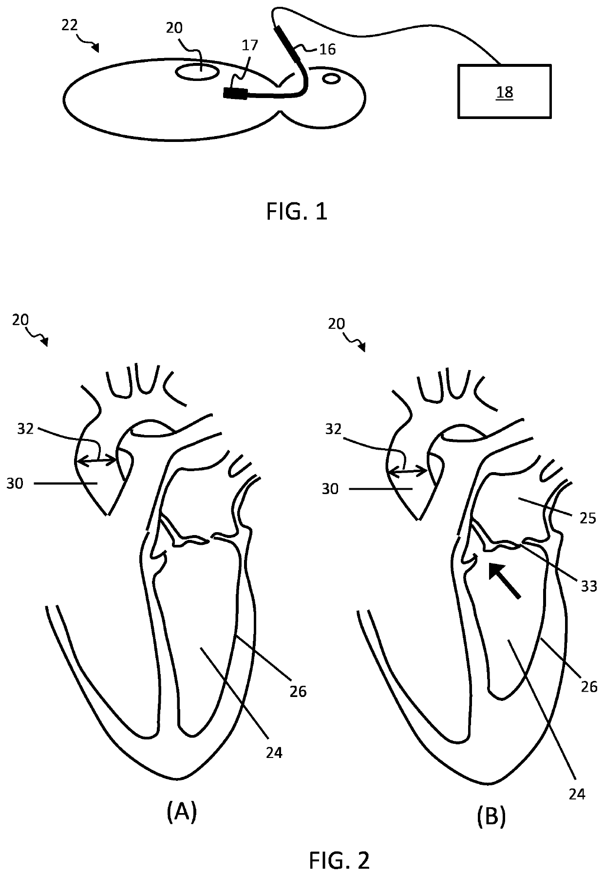 Ultrasound imaging system and method