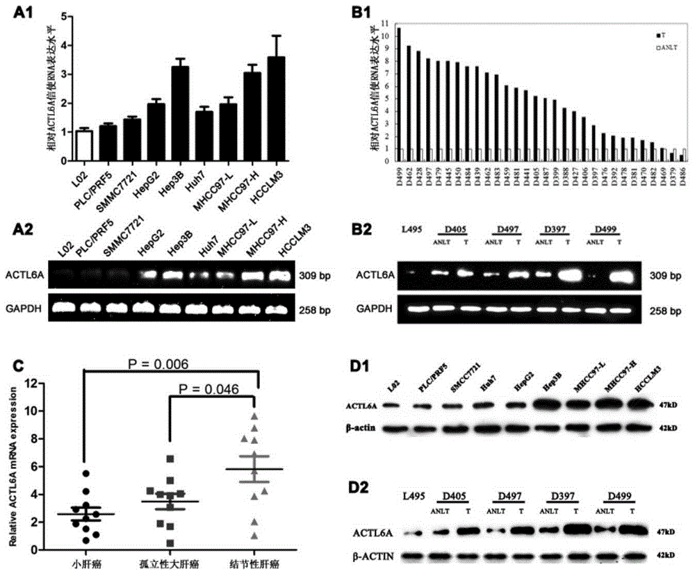 Application of ACTL6A gene to preparation of medicine for treating liver cancer or preventing relapse of liver cancer after surgery