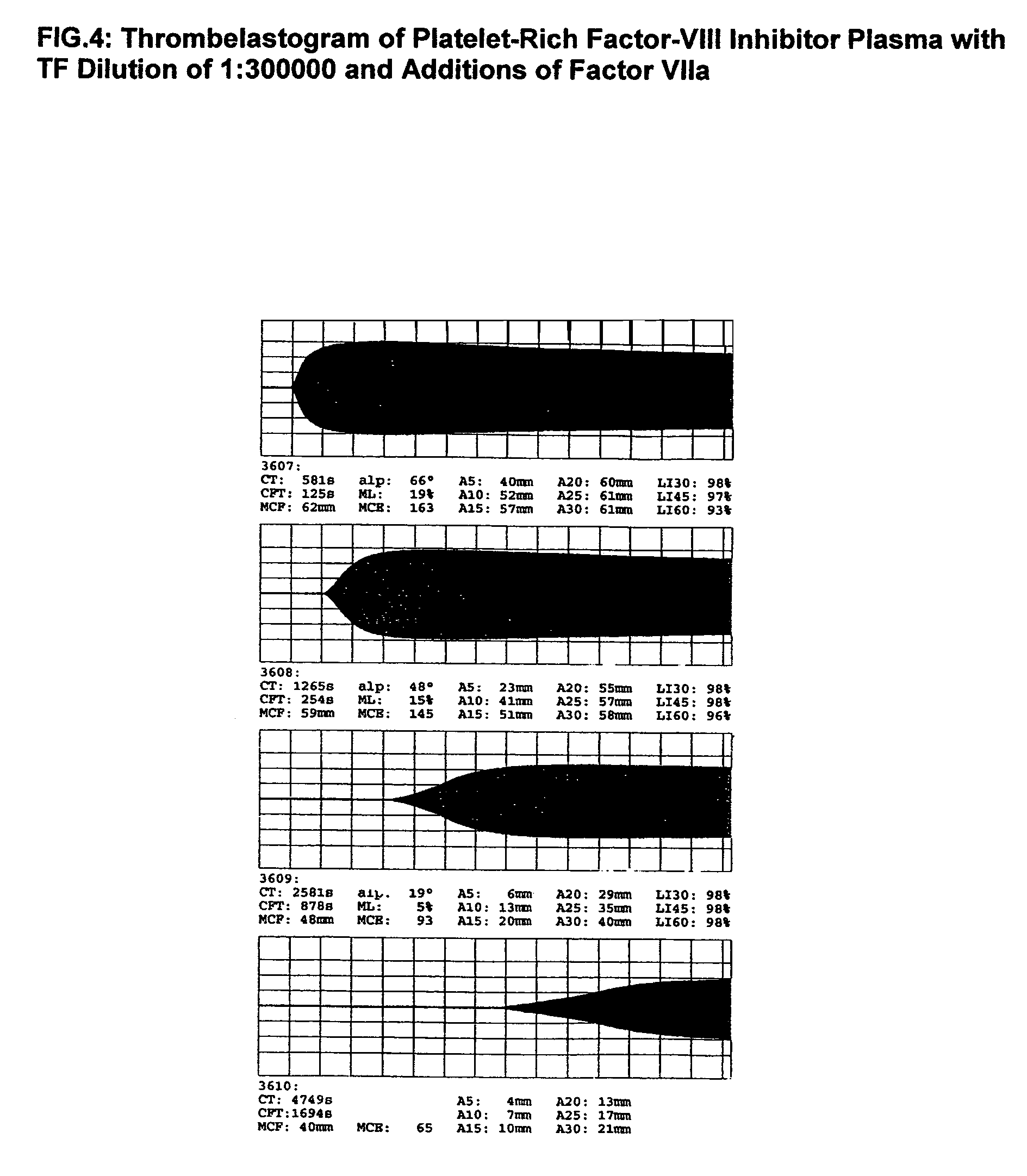 Thrombin-free composition containing freeze-dried, virally inactivated FXIa and serpins and/or kininogen