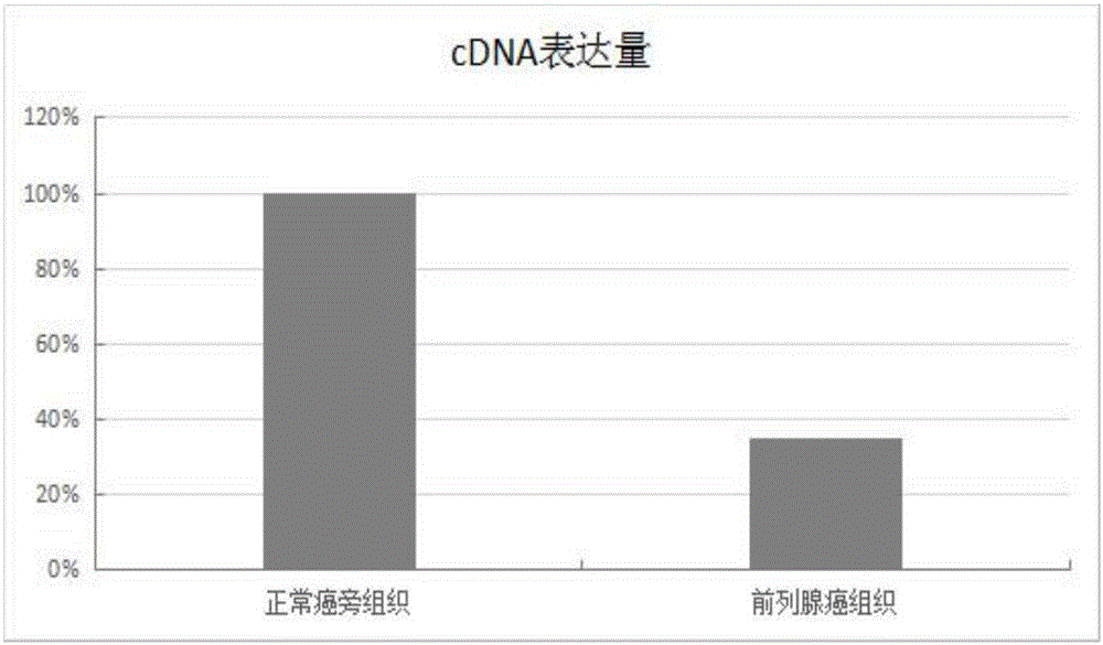 Application of SNHG10 (small nucleolar RNA host gene 10) in preparation of preparations for diagnosing prostate cancer