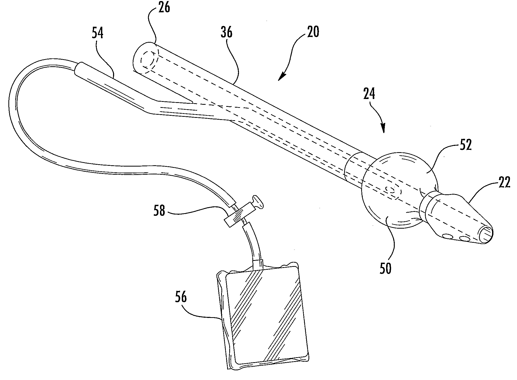 Manually Operated Insufflator