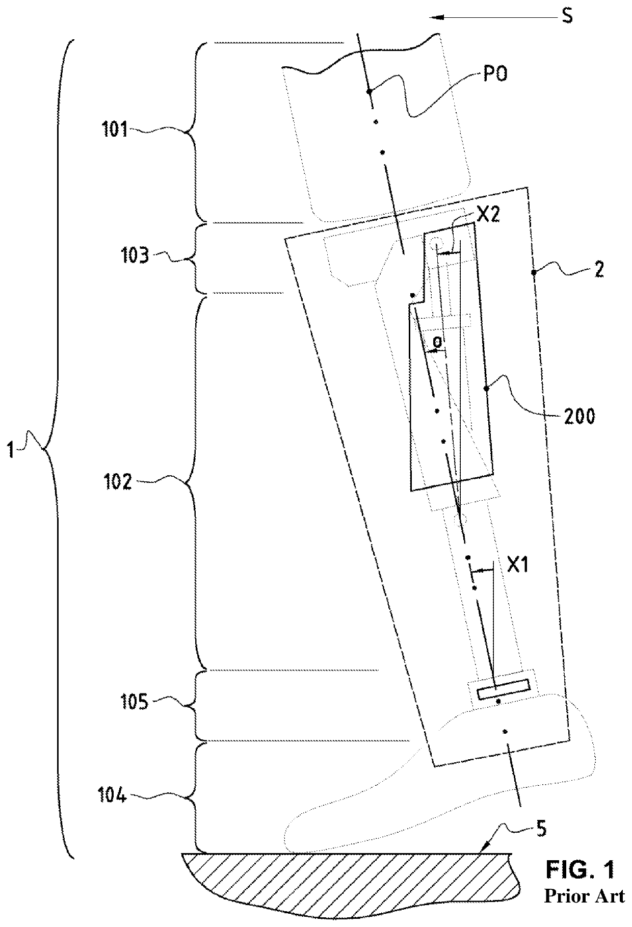 Prosthesis for femoral amputee