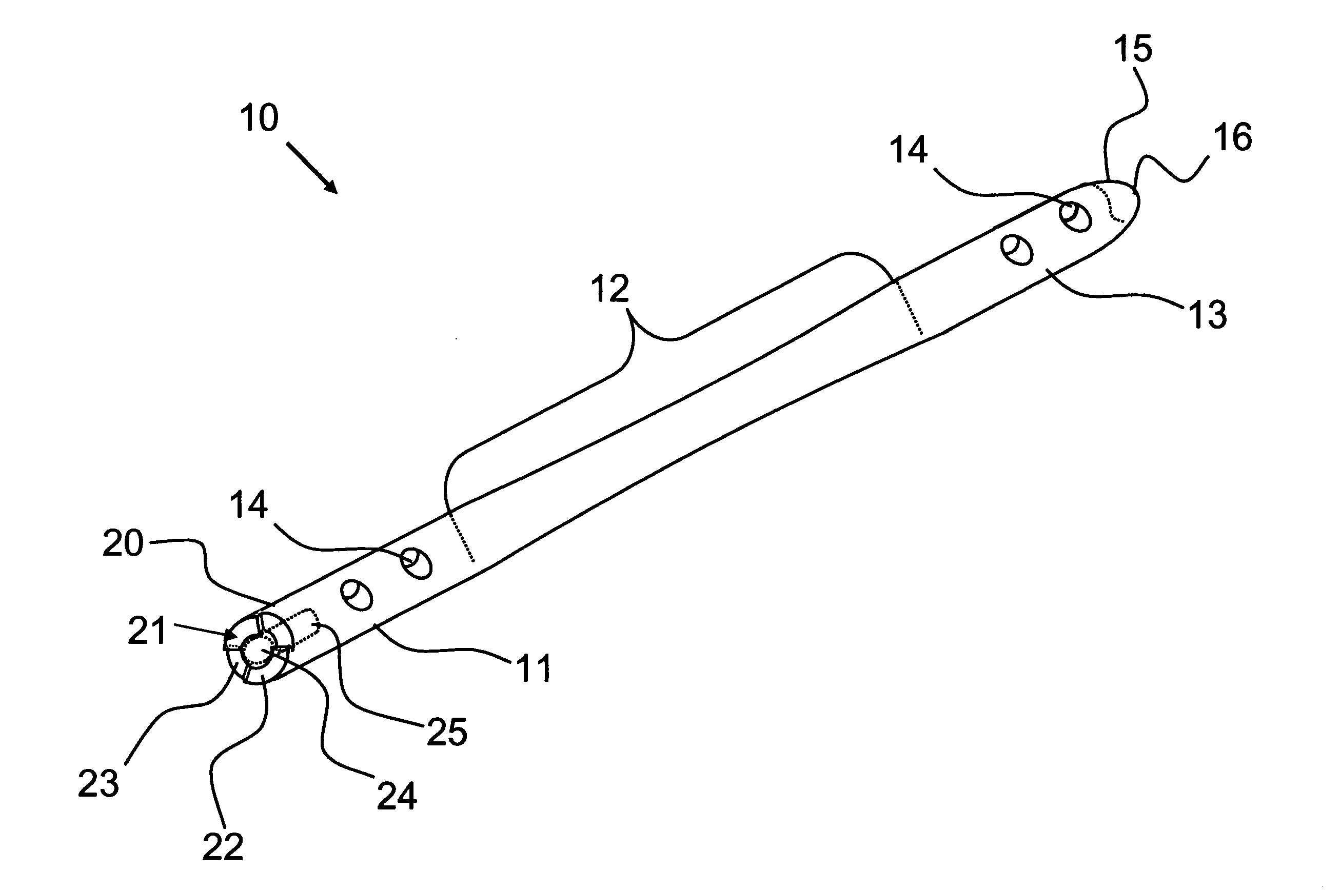 Interlocking nail geometry and method of use