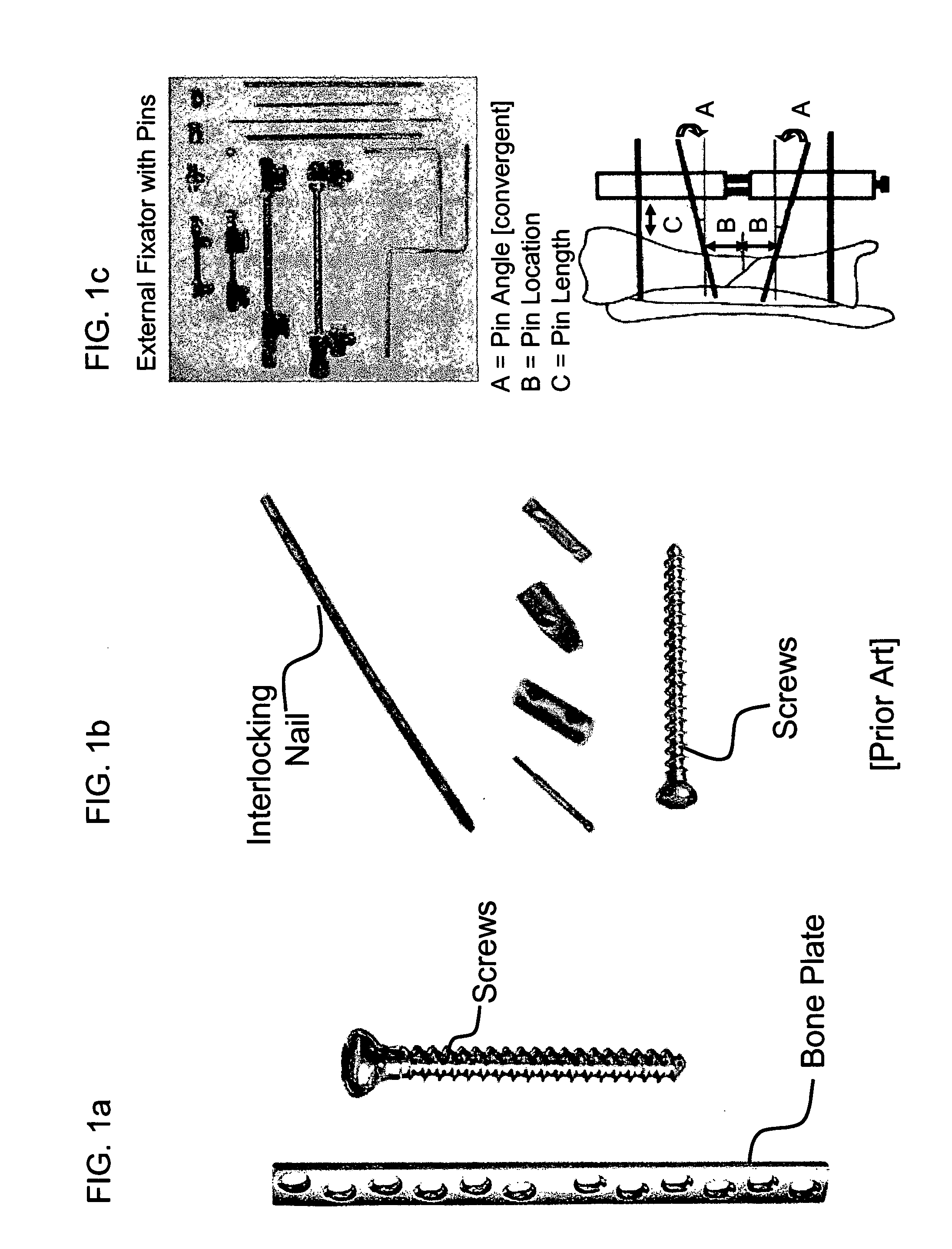 Interlocking nail geometry and method of use