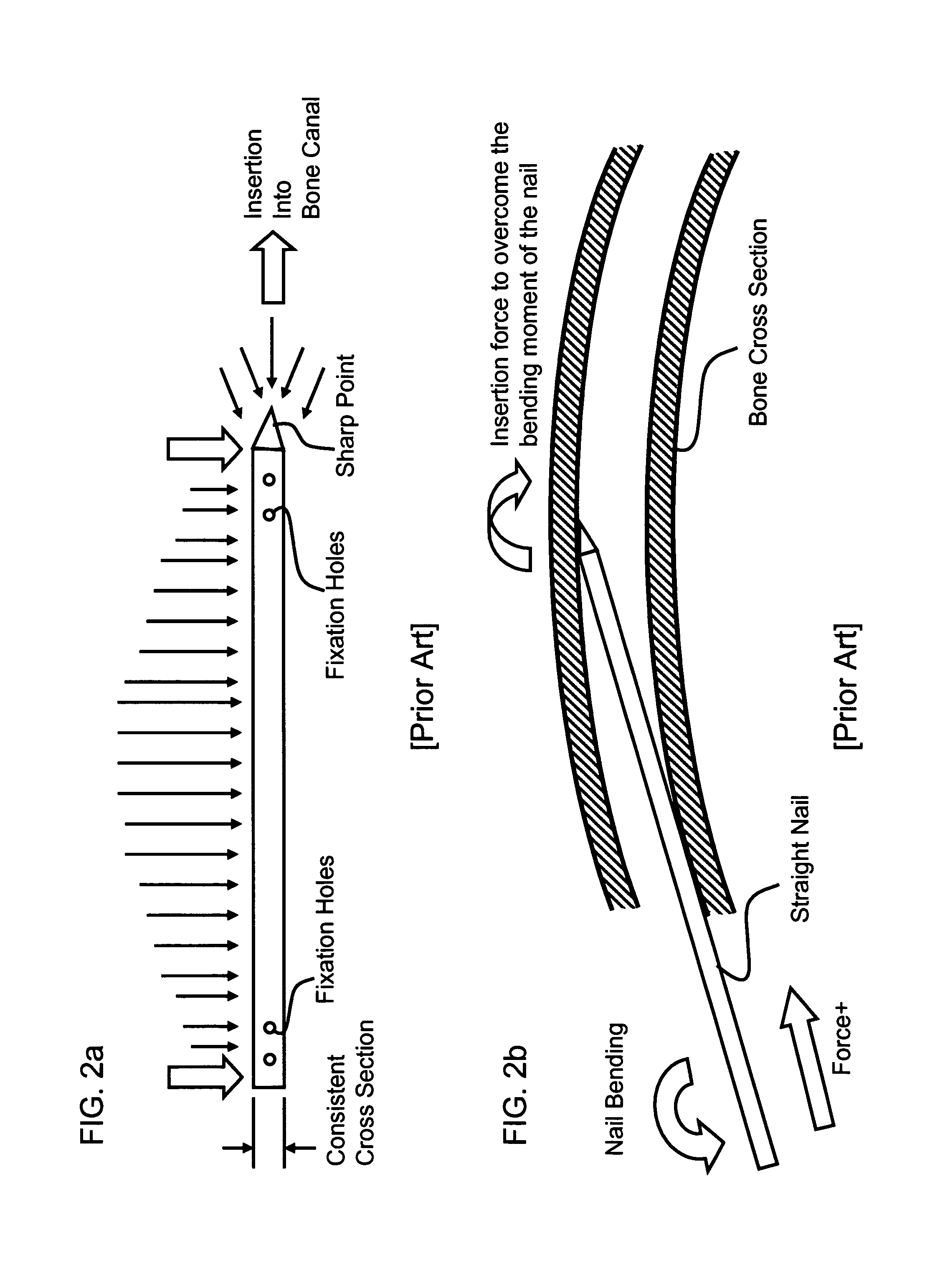 Interlocking nail geometry and method of use