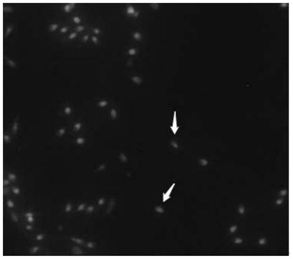 Specific nucleic acid fluorescent staining reaction liquid and application thereof in sperm DNA integrity detection