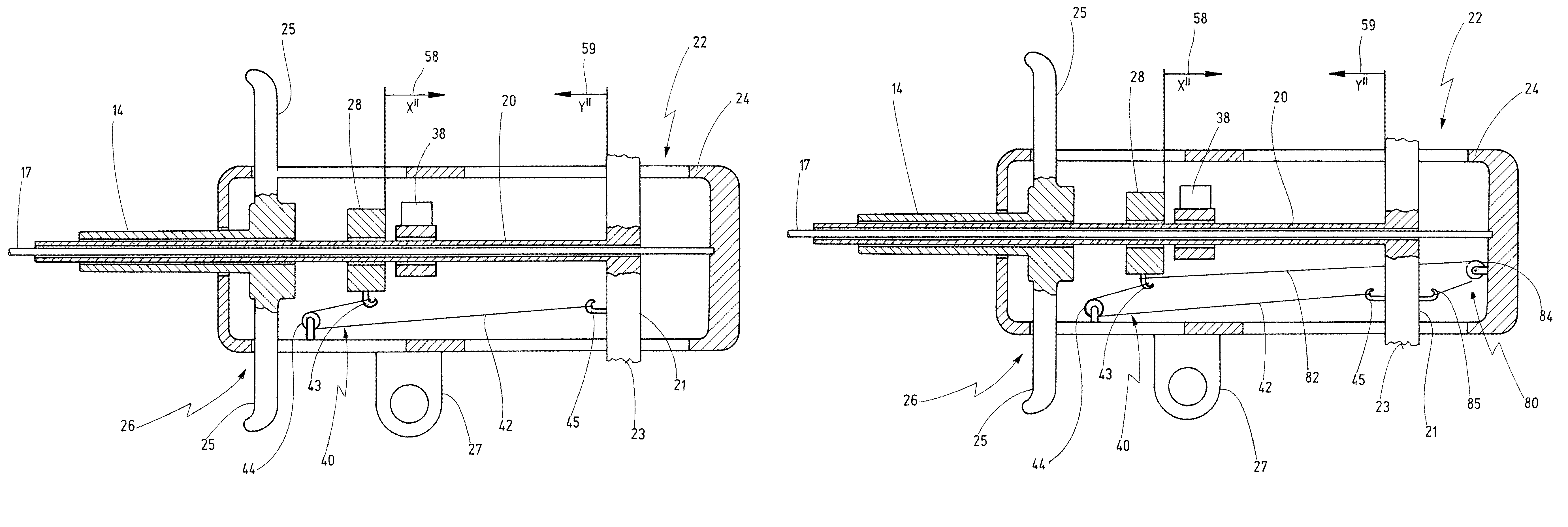 Insertion system for stents, comprising tension-compression kinematics