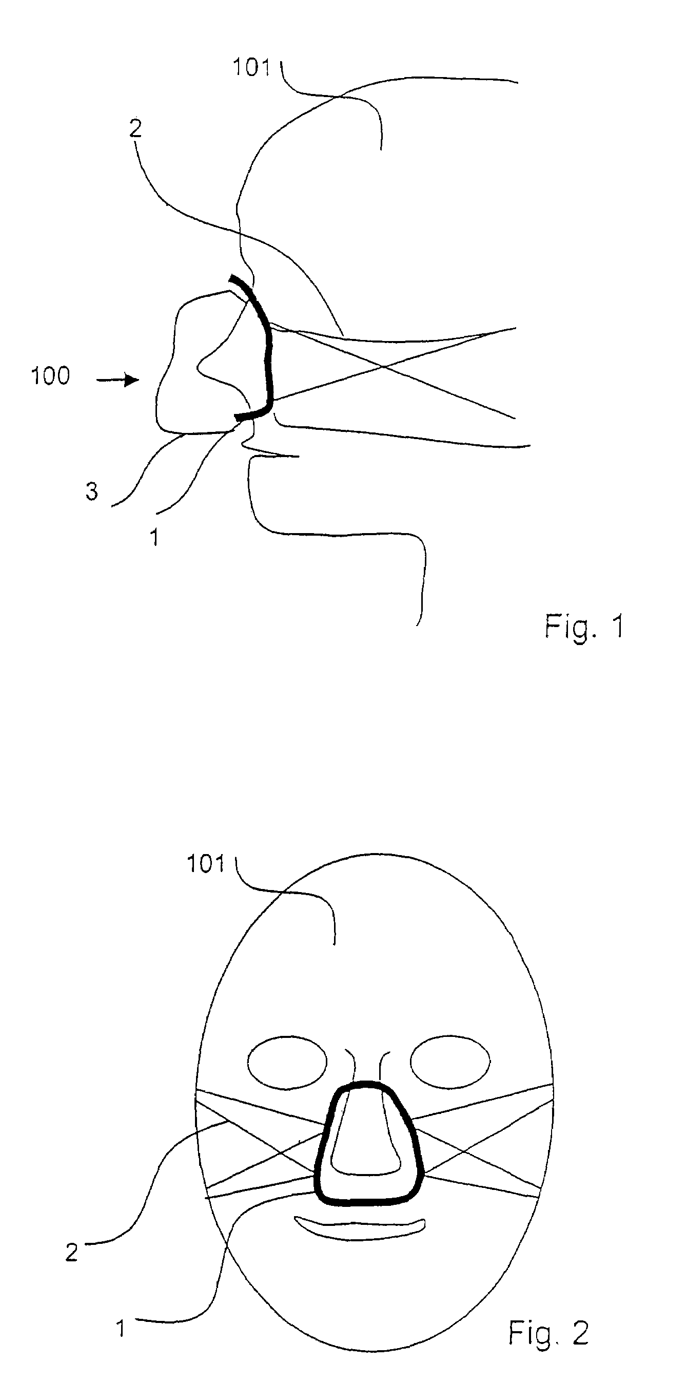 Breathing mask with individual adaptation to the shape of the face