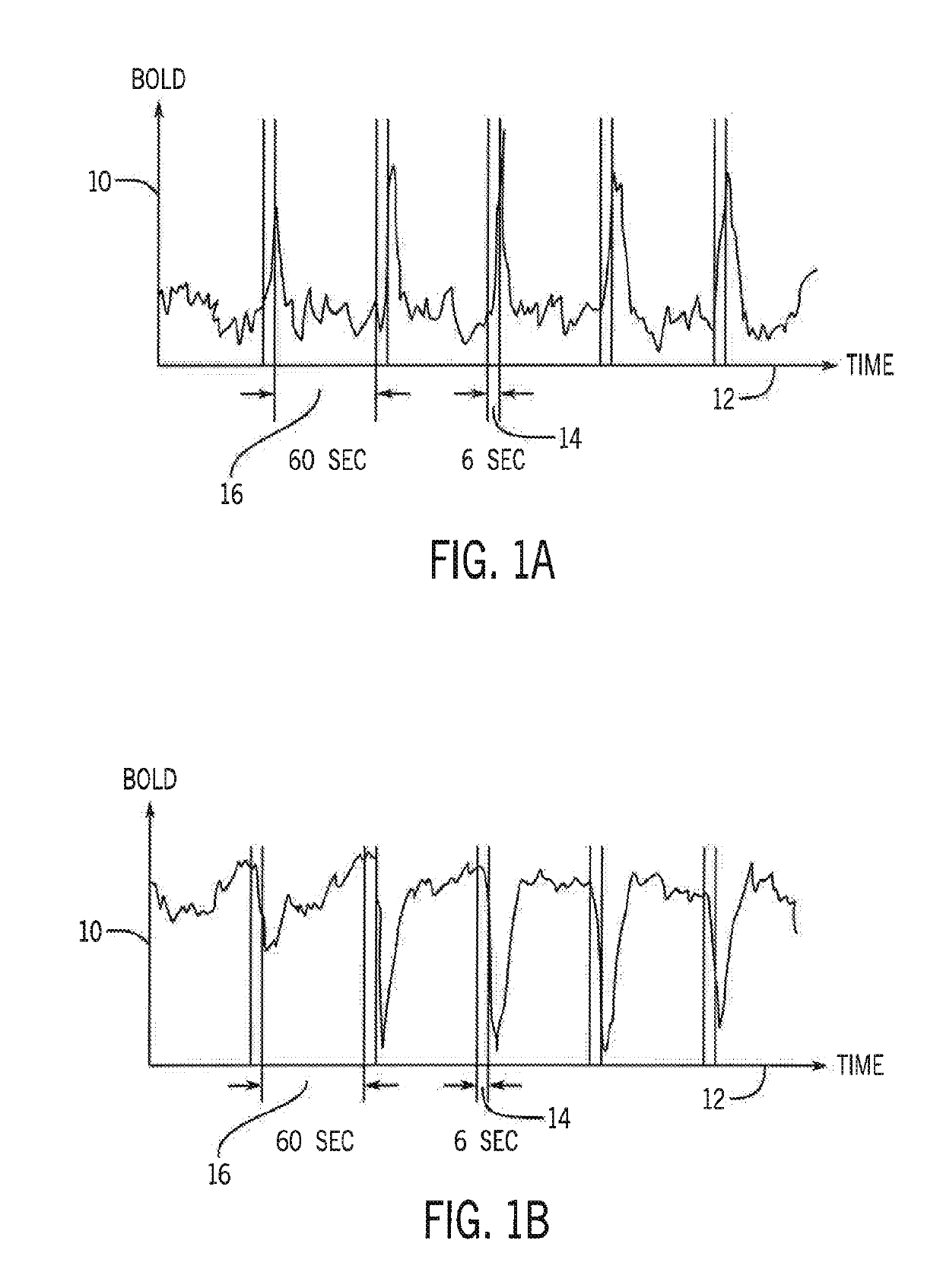 Neuromodulation to Modulate Glymphatic Clearance