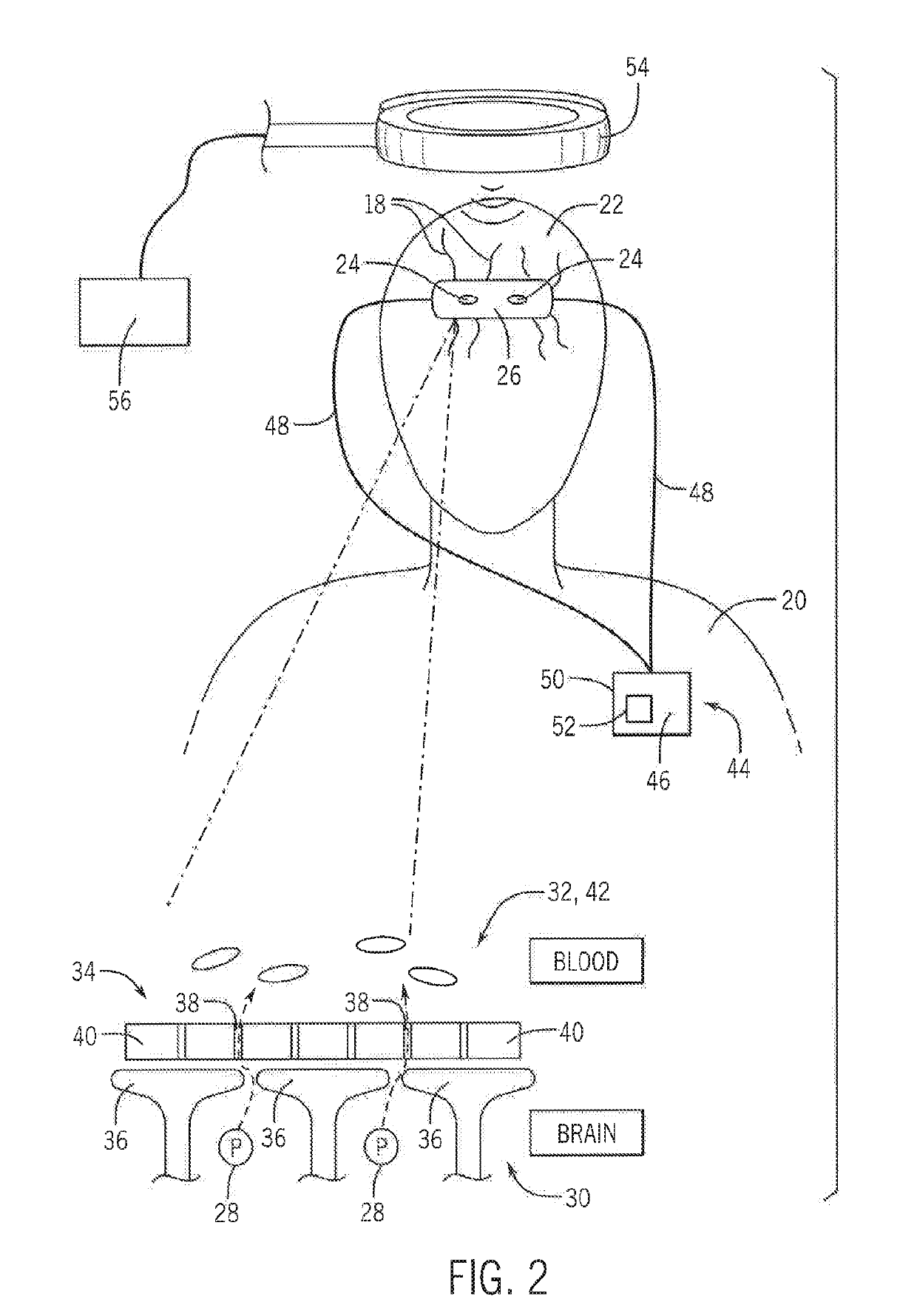 Neuromodulation to Modulate Glymphatic Clearance