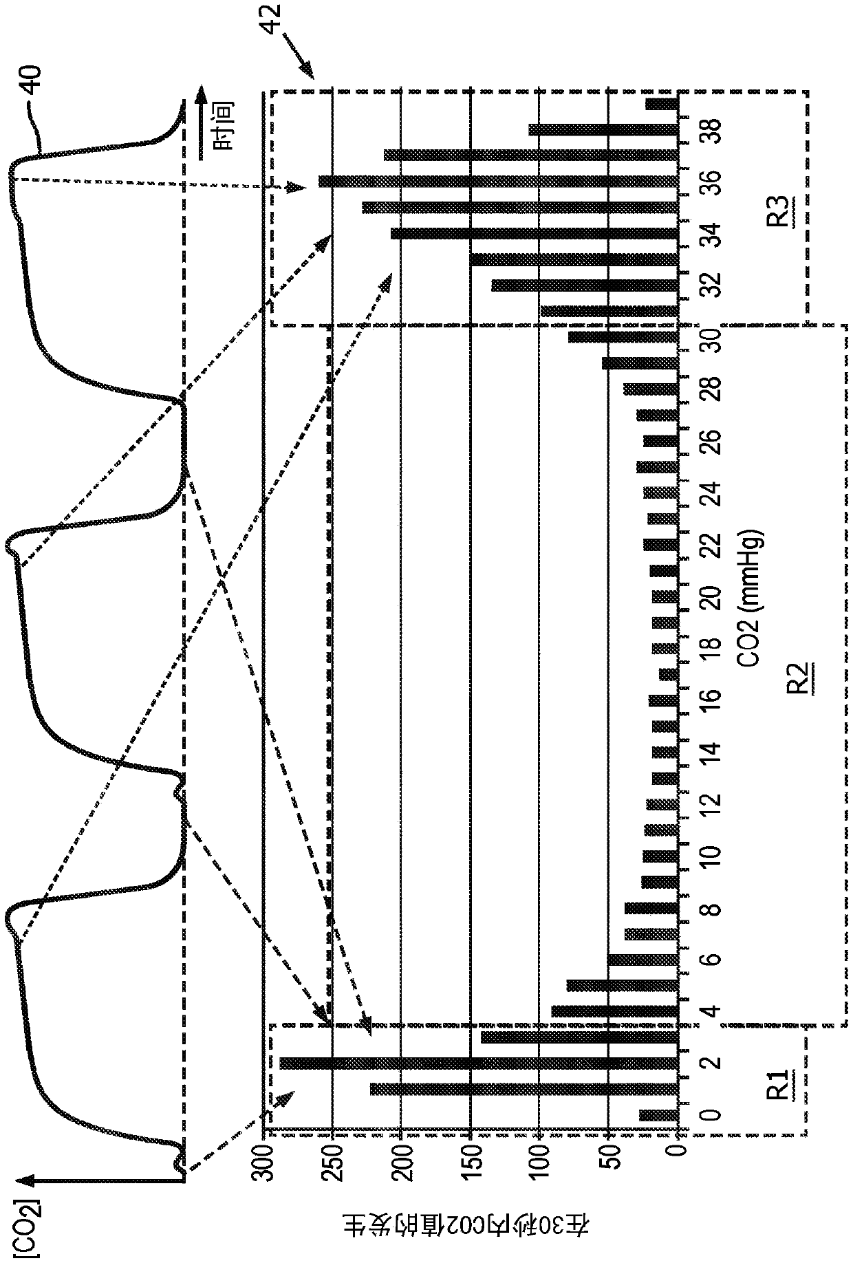 Capnography with decision support system architecture