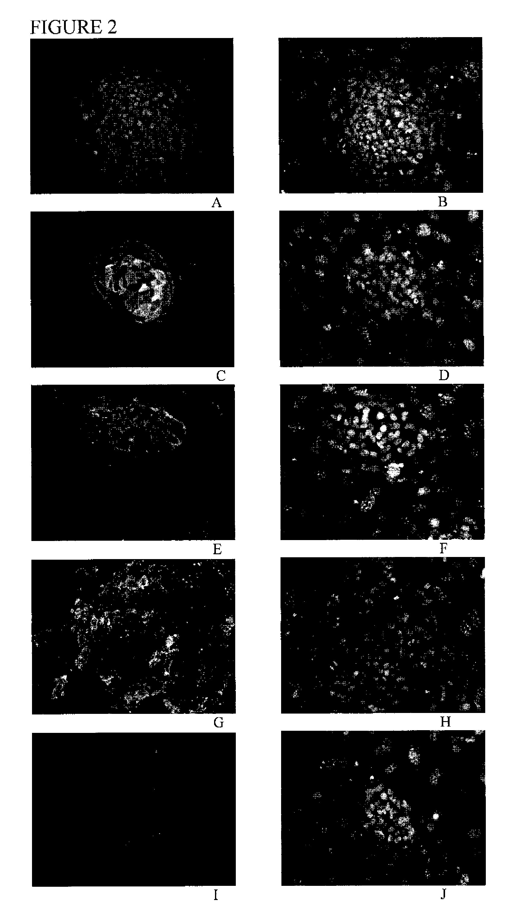 Alternative Compositions and Methods for the Culture of Stem Cells