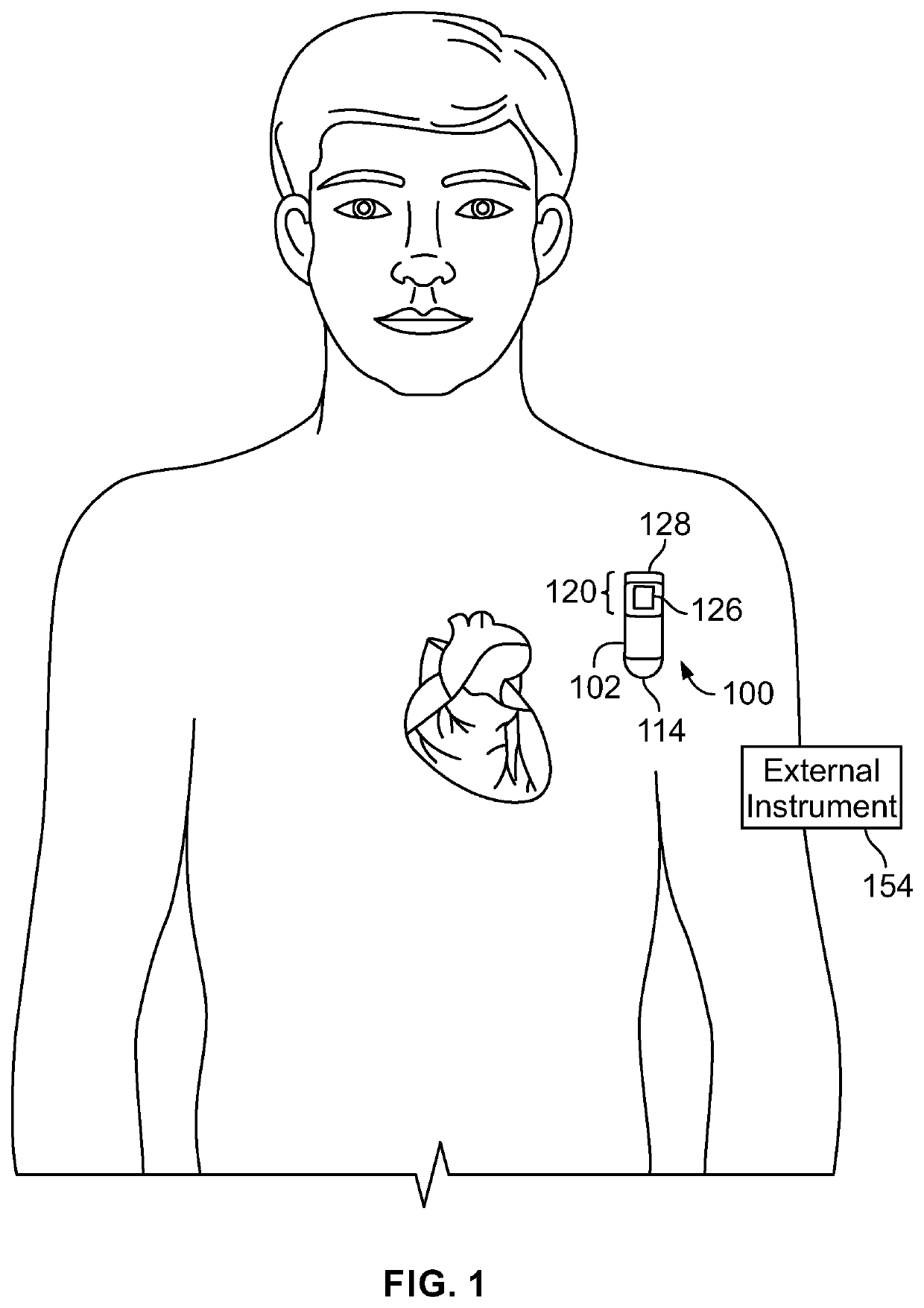 Methods and systems to confirm device classified arrhythmias utilizing machine learning models