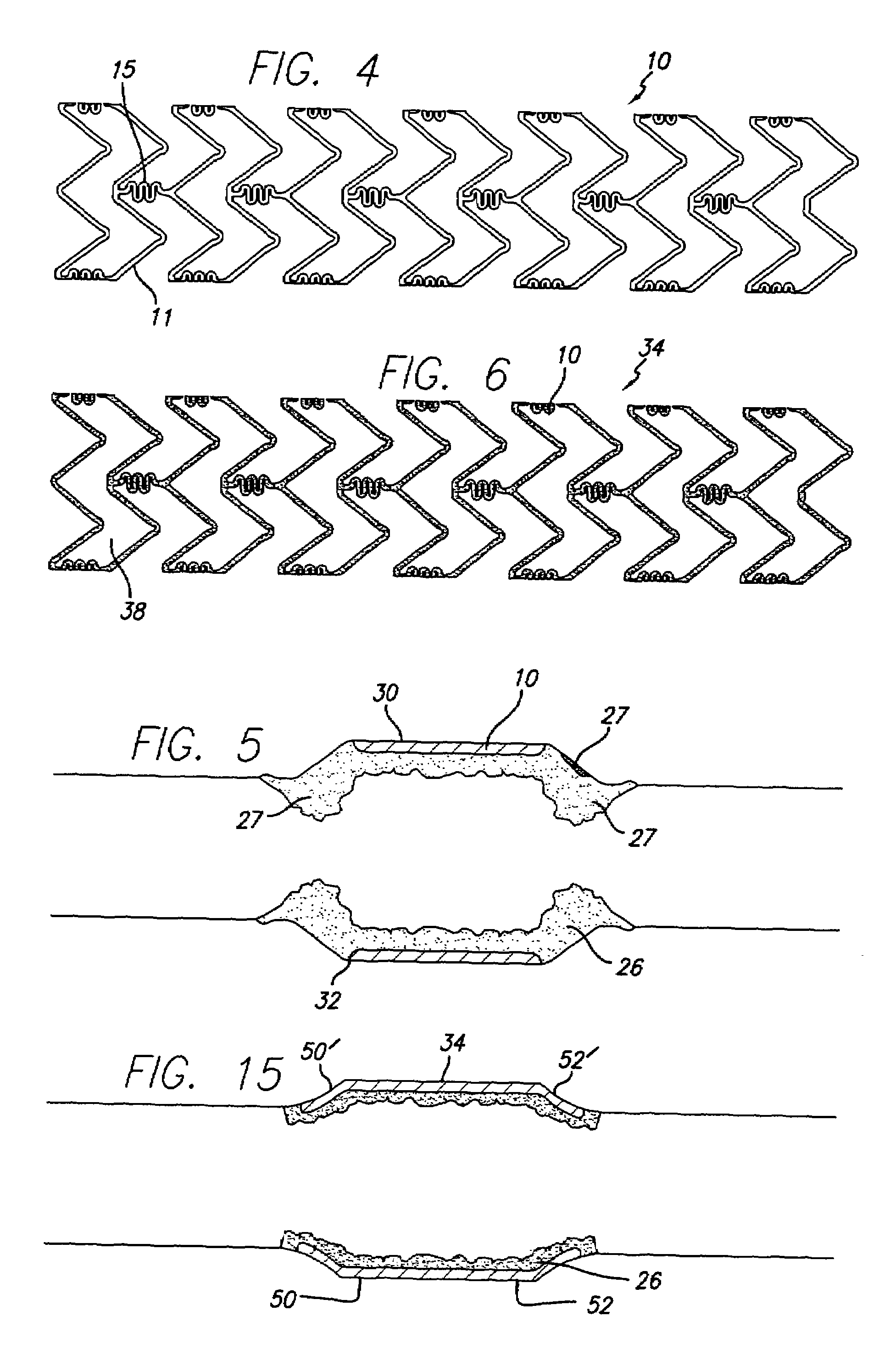 Drug-eluting stent and delivery system with tapered stent in shoulder region