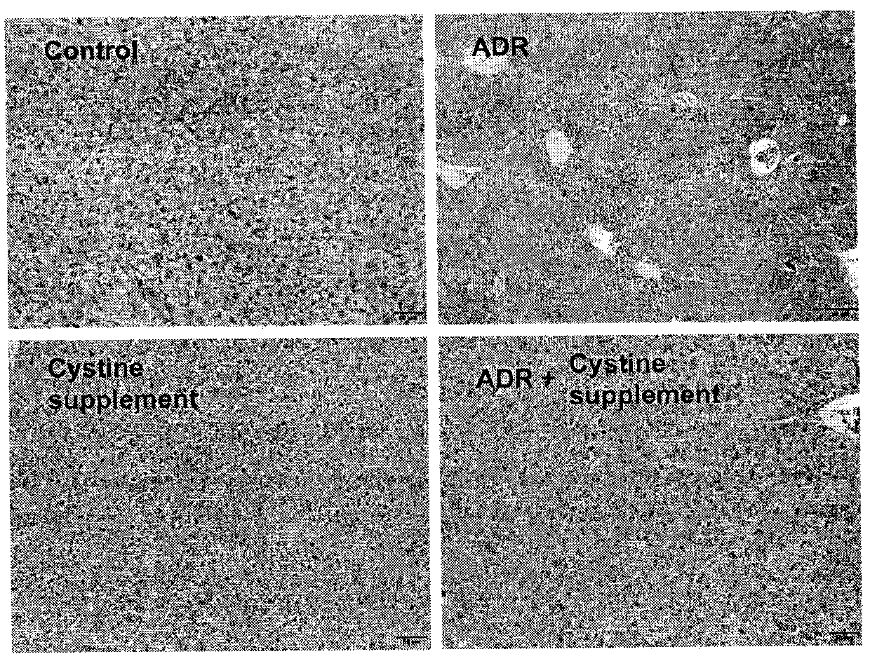 An application of cystine in preparation of a medicine for reducing hepatotoxicity caused by adriamycin