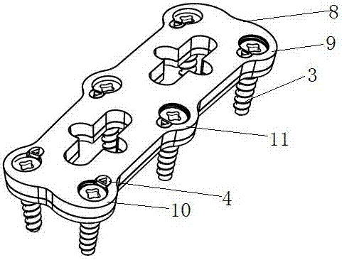 A spinal fixation device