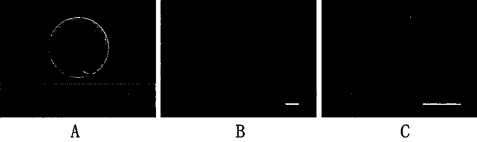 Method for preparing stem cell patch for treating severe skin diseases and injuries