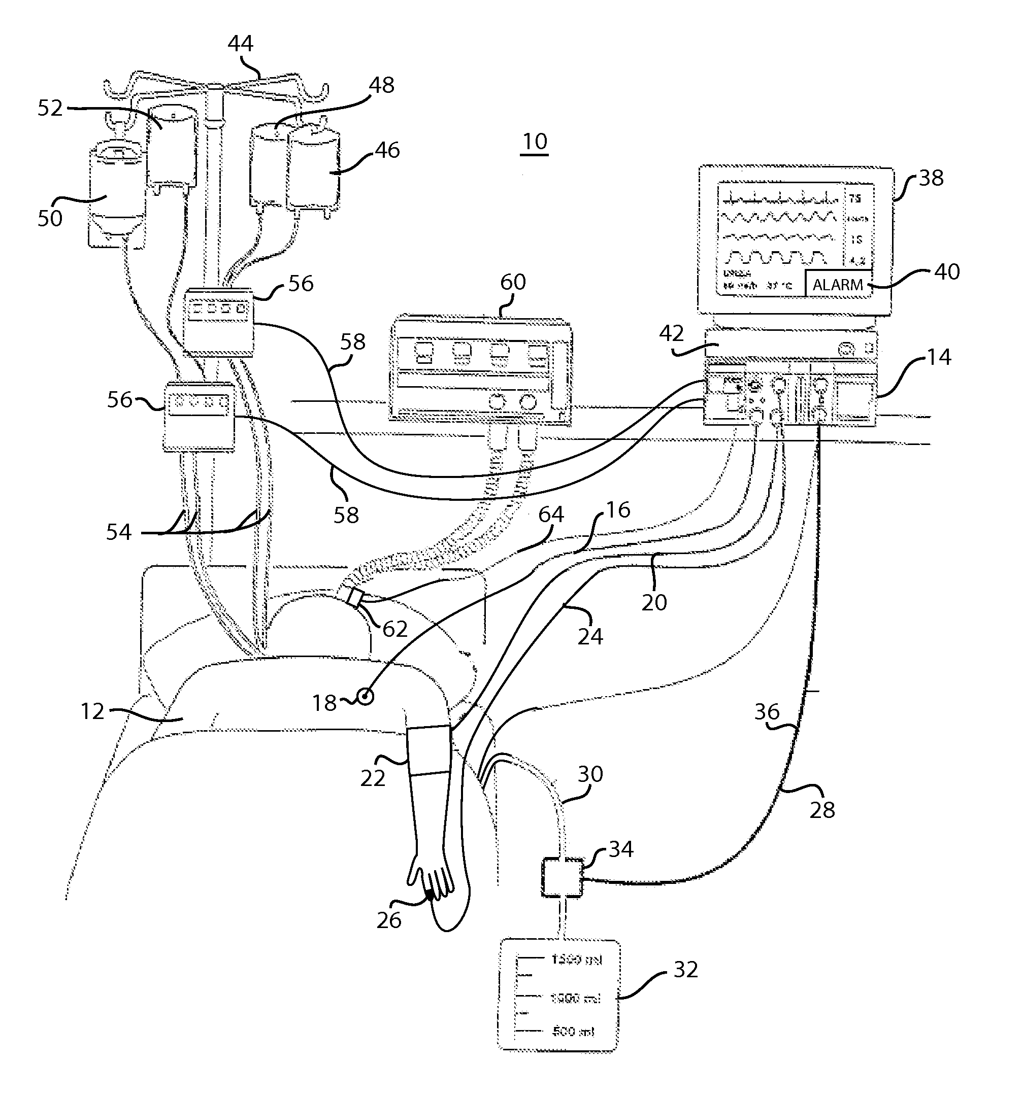 Fluid management measurement module