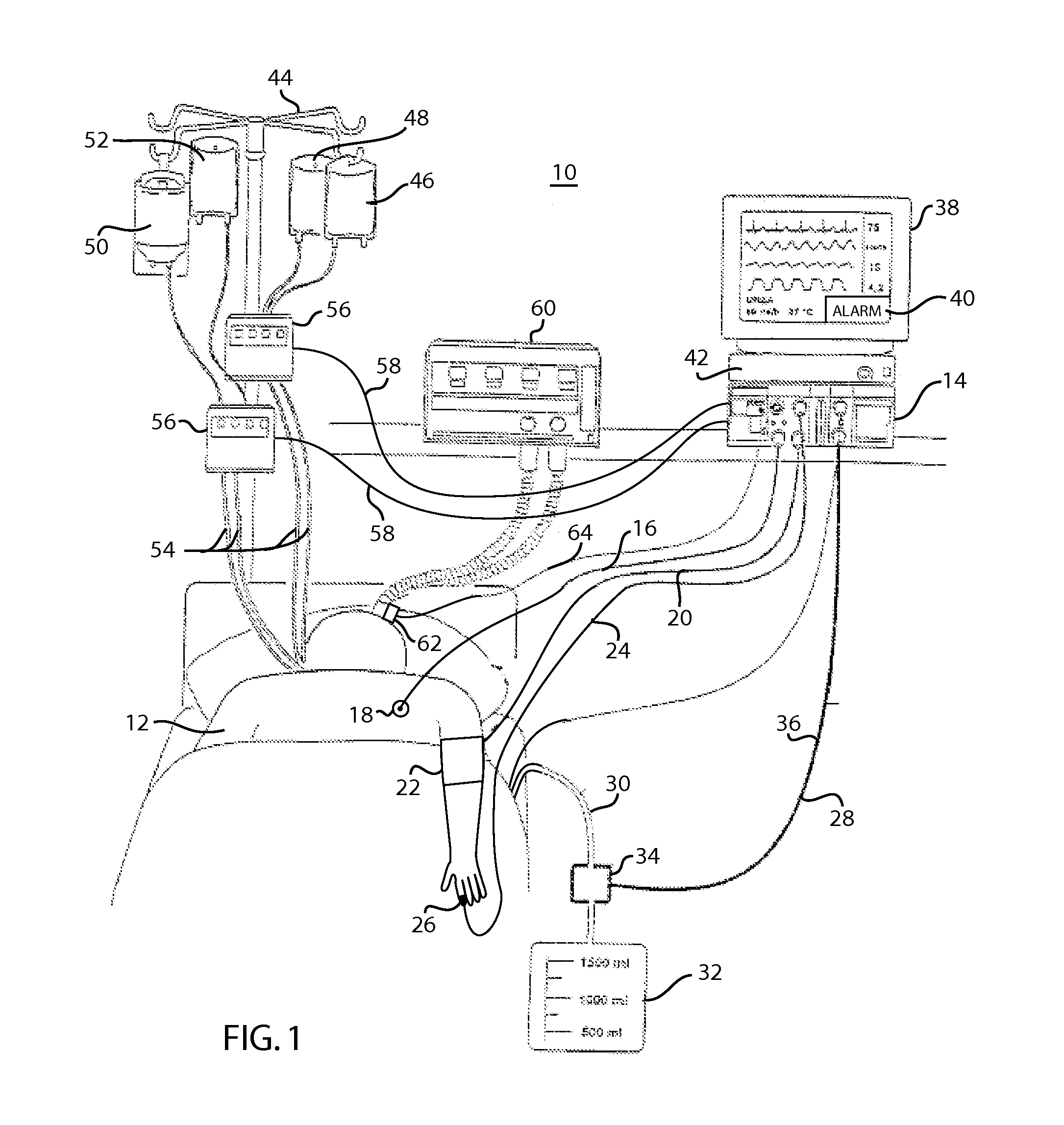 Fluid management measurement module