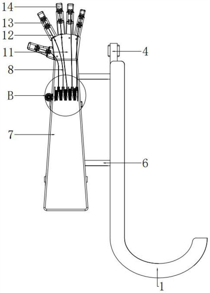 Hand injury fracture rehabilitation nursing frame