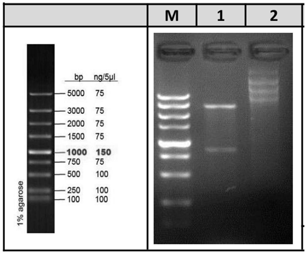 Preparation and application of fusion protein genetically engineered bacterium of coccidium antigen peptide/IL5