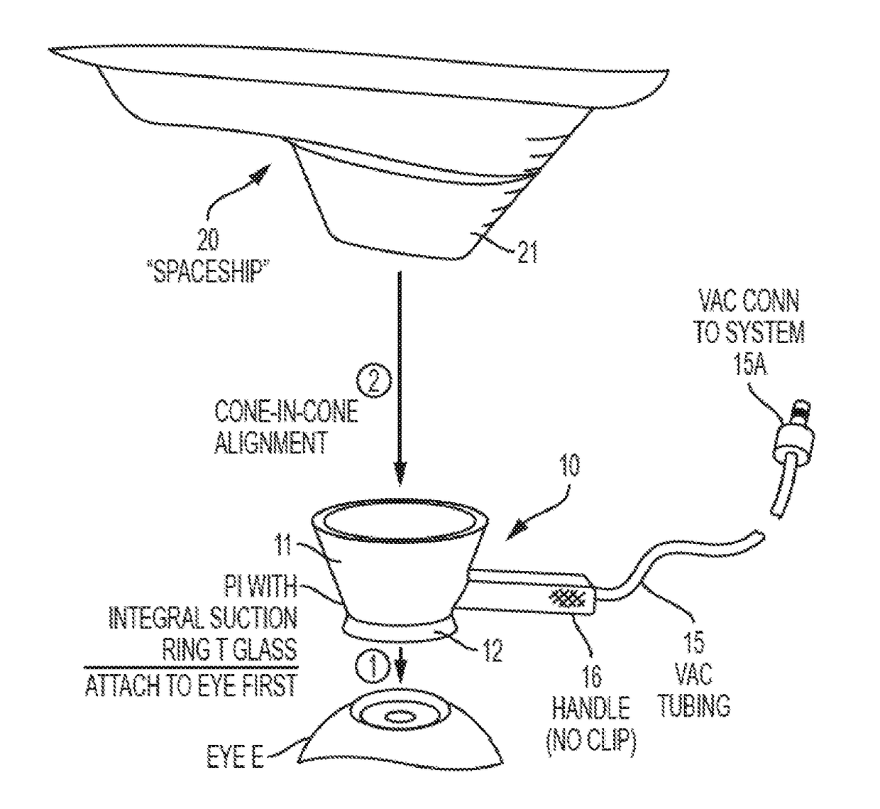 Patient interface device for ophthalmic surgical laser system