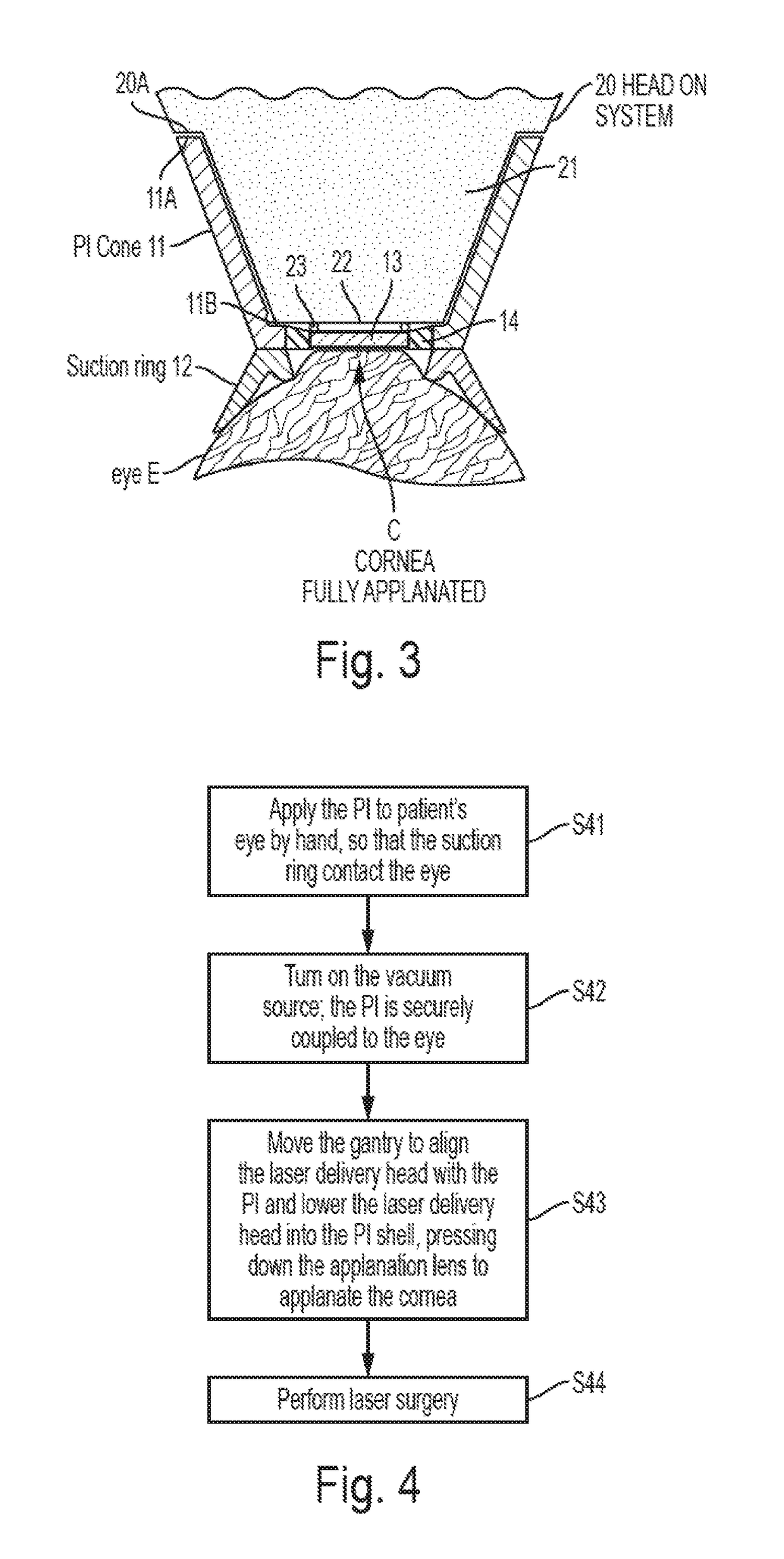 Patient interface device for ophthalmic surgical laser system