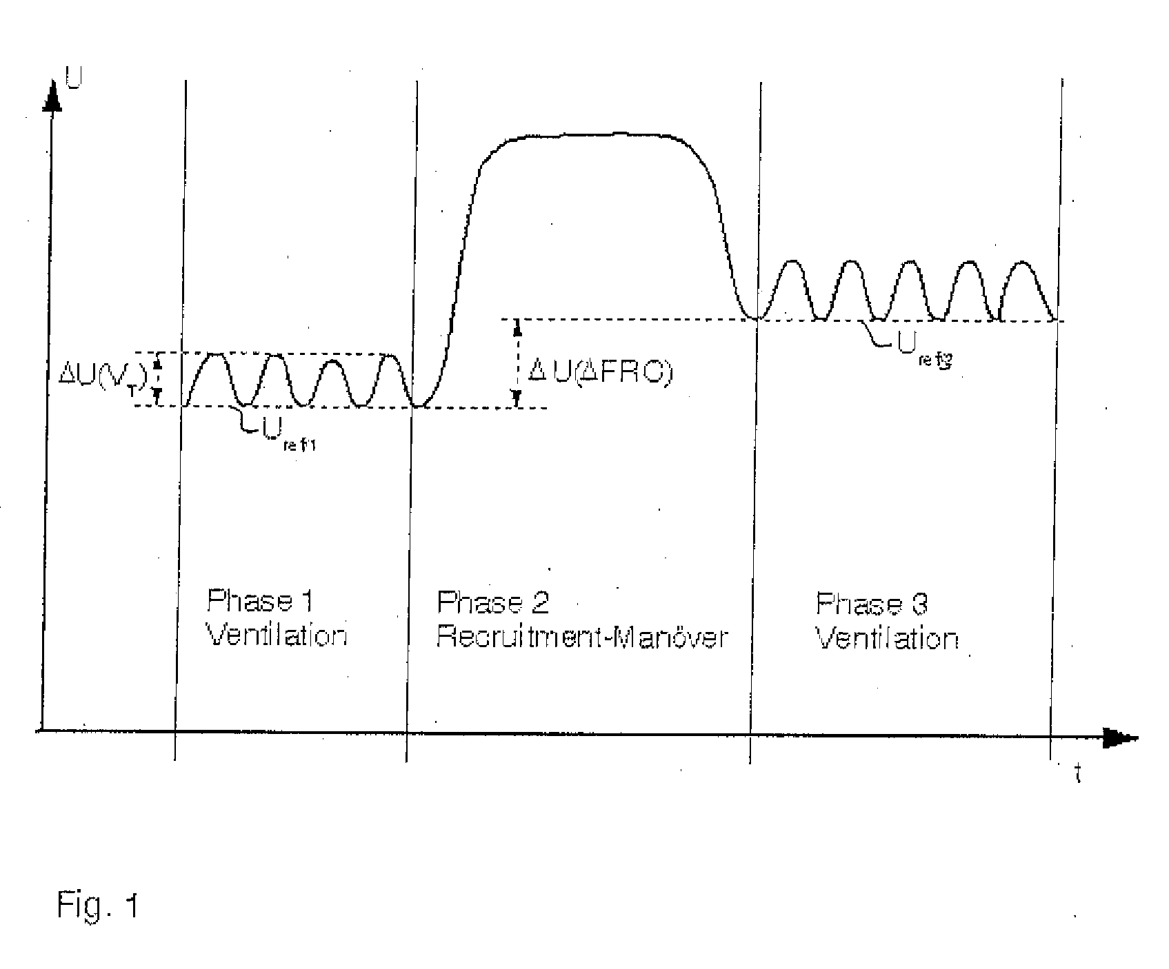 Device and process for controlling a respirator