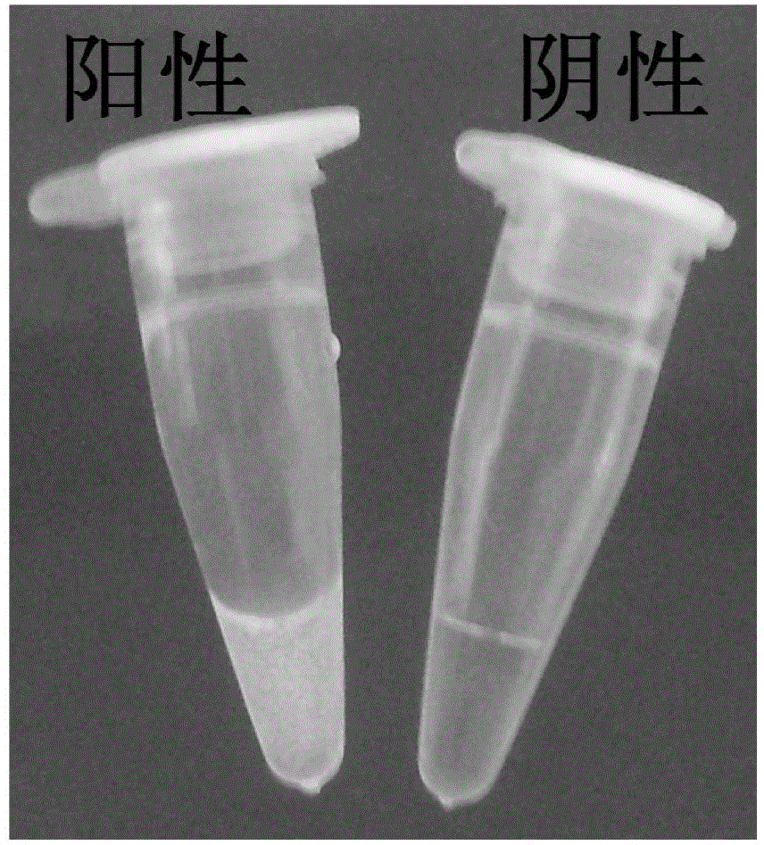 RT-LAMP method for identifying Japanese encephalitis virus gene types I and III