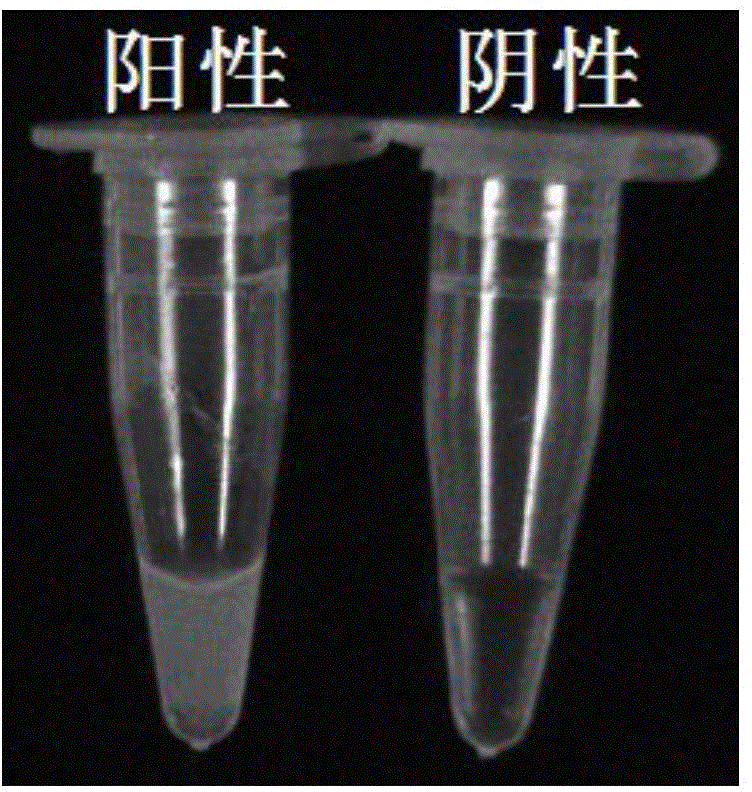 RT-LAMP method for identifying Japanese encephalitis virus gene types I and III