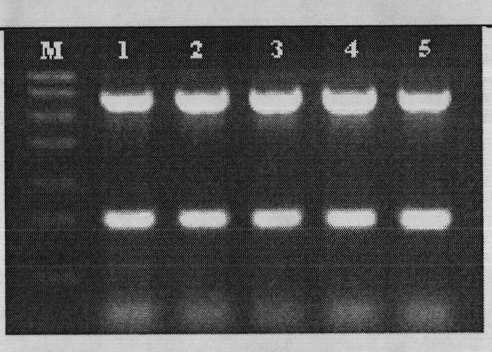 Kit for detecting porcine pseudorabies virus (PRV) and porcine parvovirus (PPV)