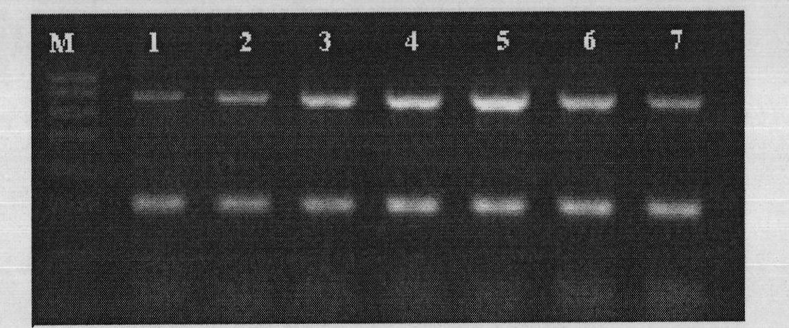 Kit for detecting porcine pseudorabies virus (PRV) and porcine parvovirus (PPV)