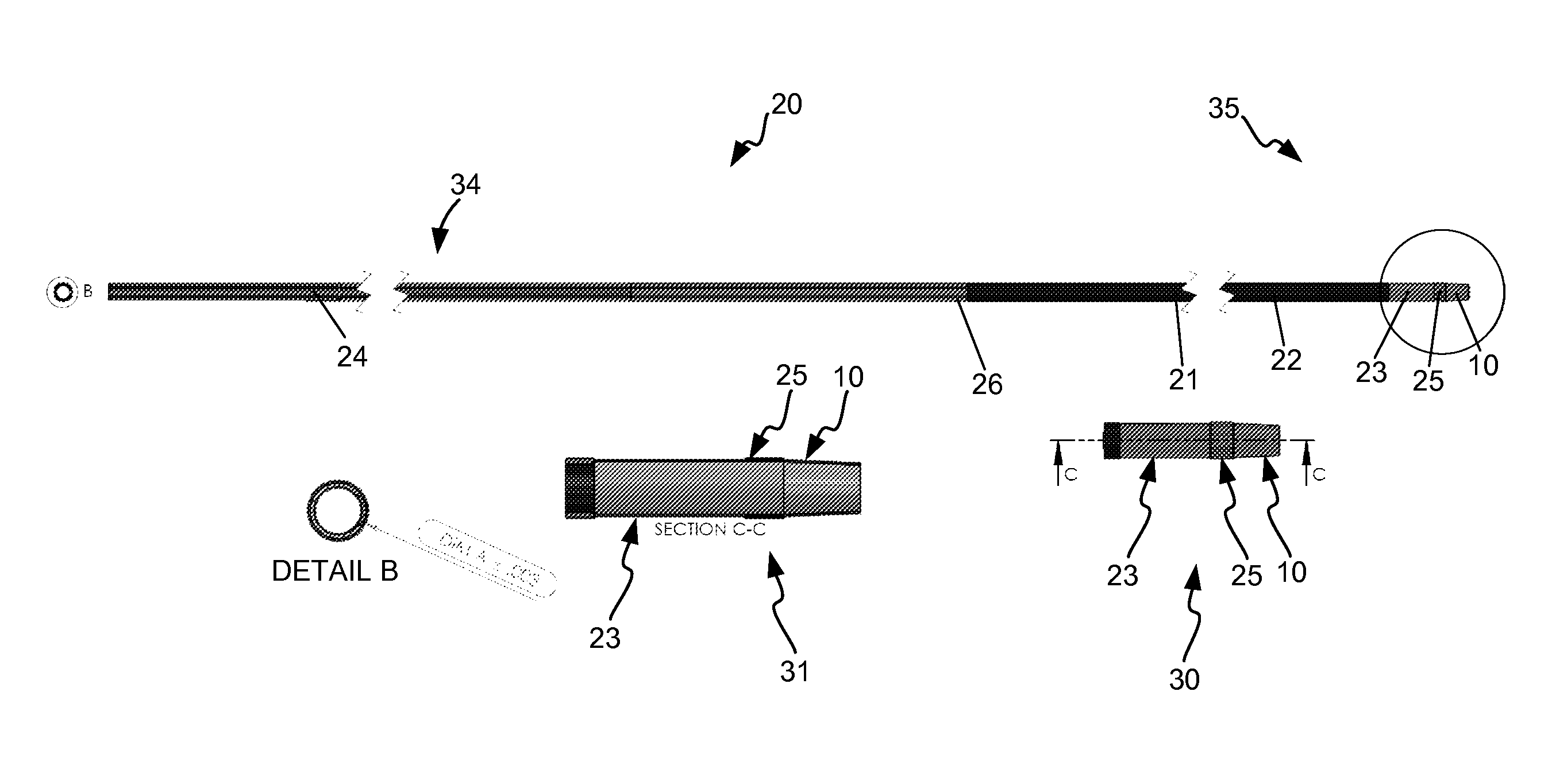 Elastic tip for an adjustable length angioplasty balloon sheath