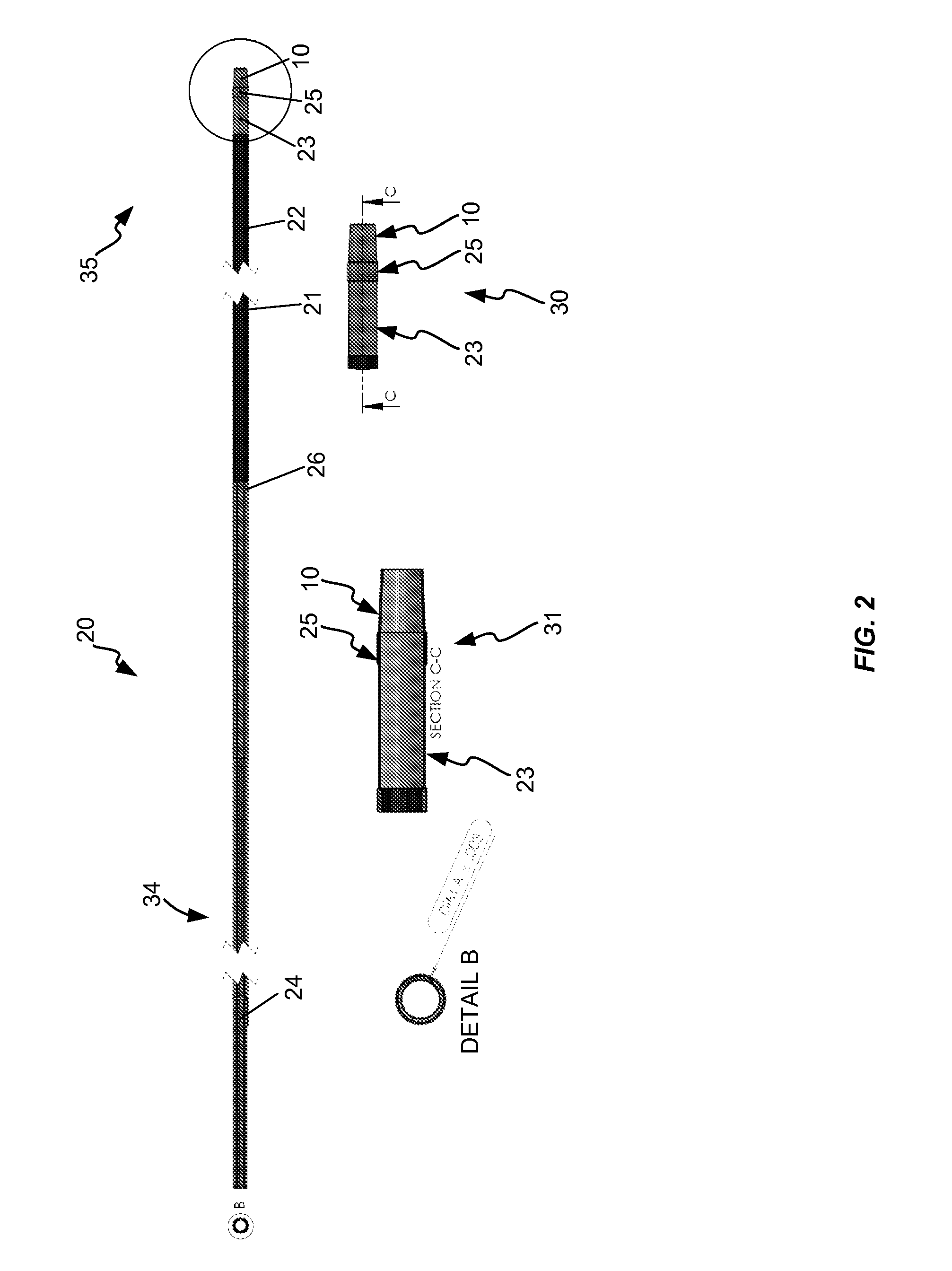 Elastic tip for an adjustable length angioplasty balloon sheath