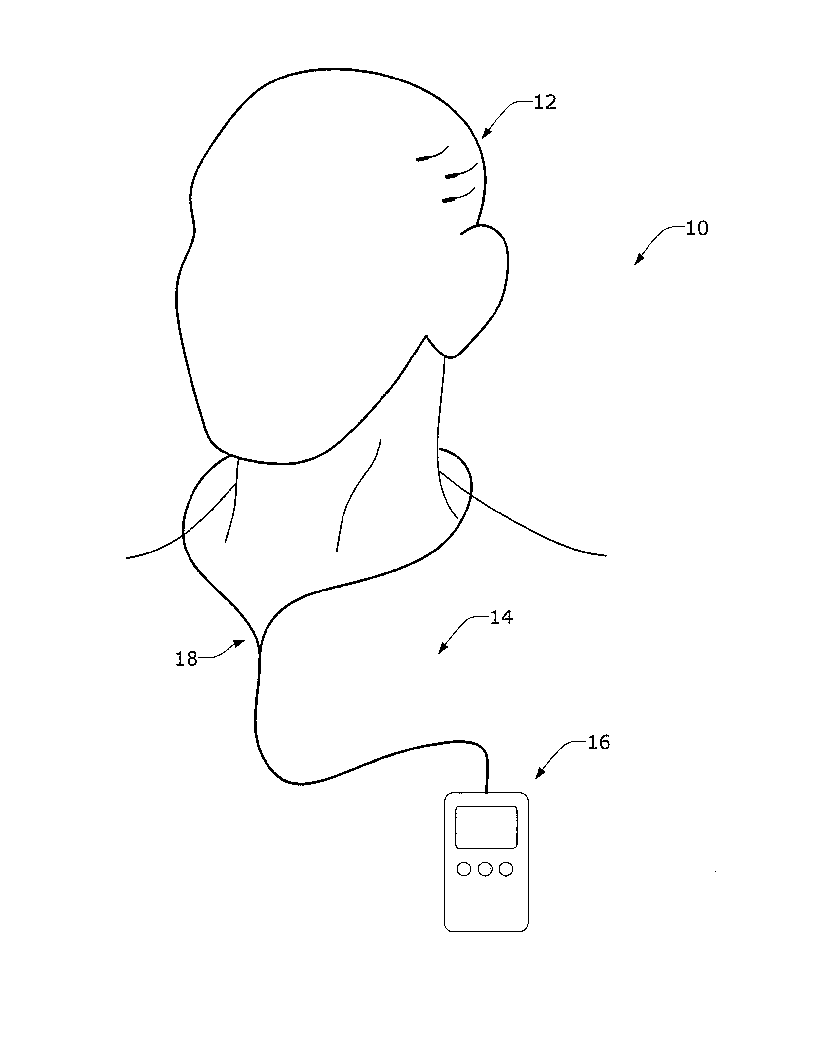 Minimally Invasive Monitoring Systems