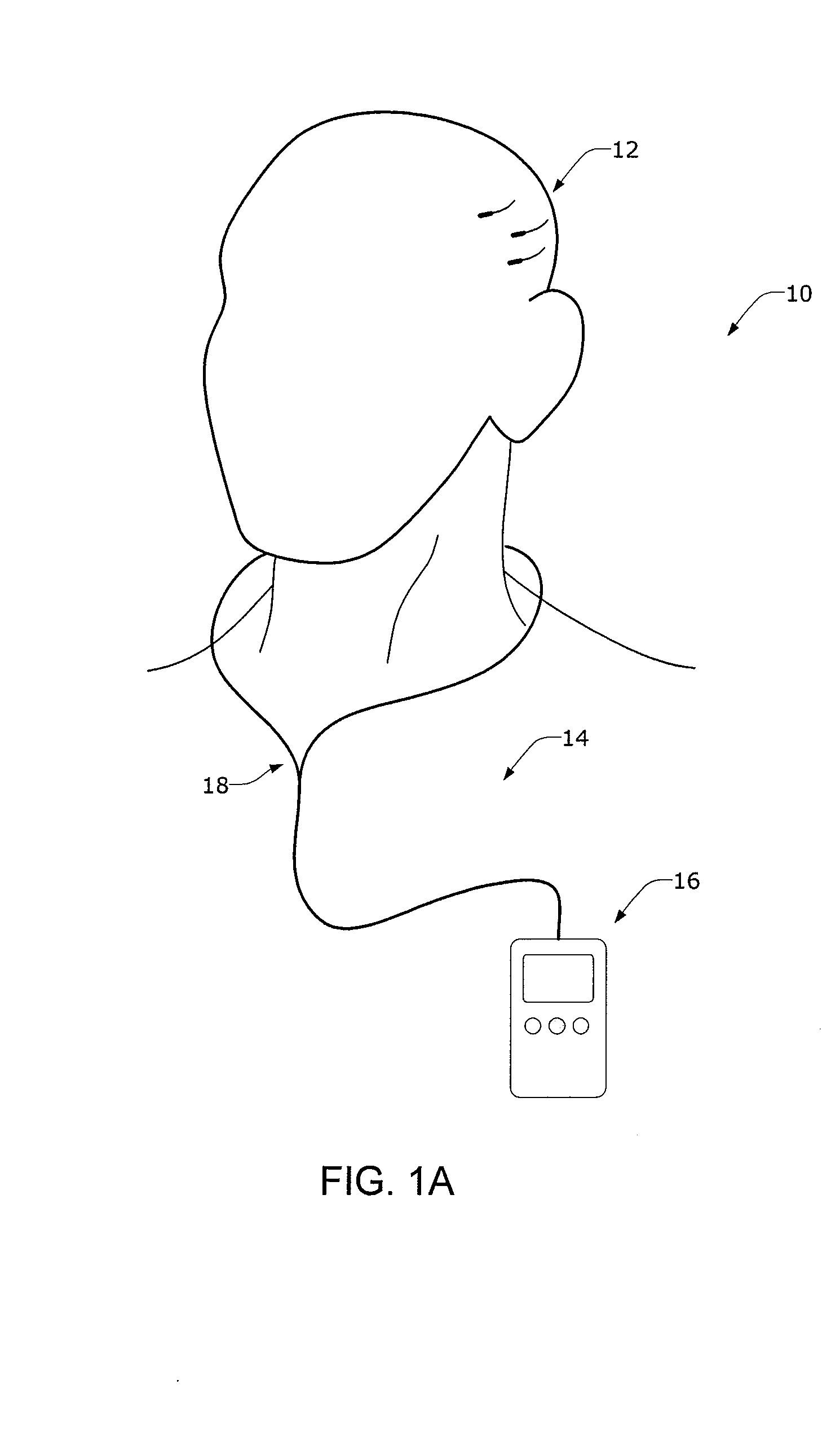 Minimally Invasive Monitoring Systems