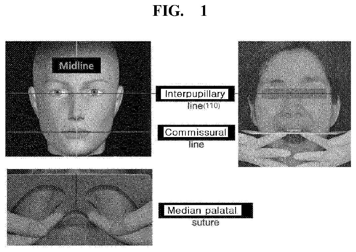 Assembly type rod for recording occlusal plane