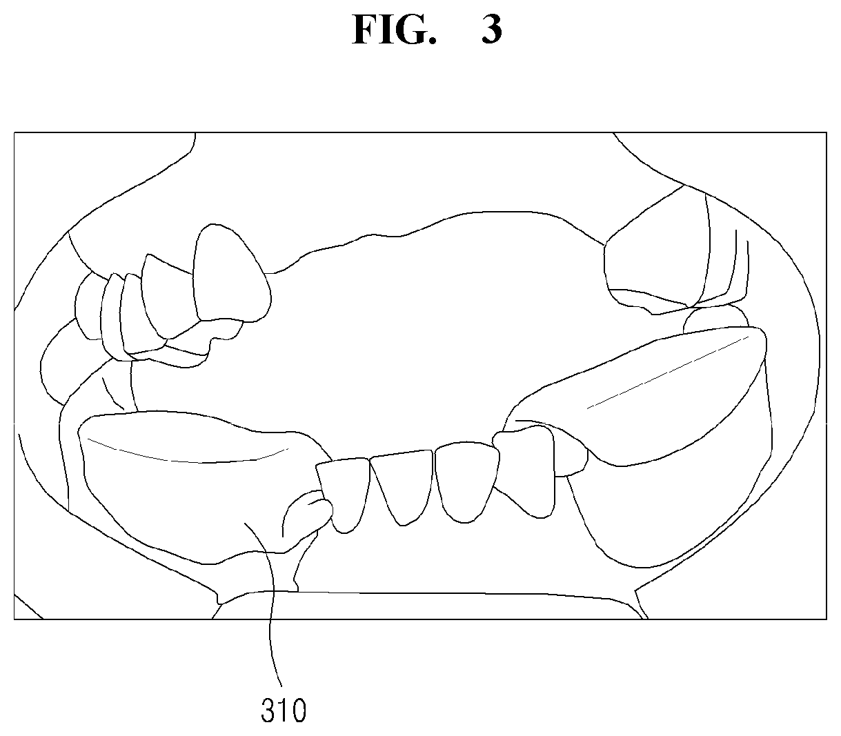 Assembly type rod for recording occlusal plane