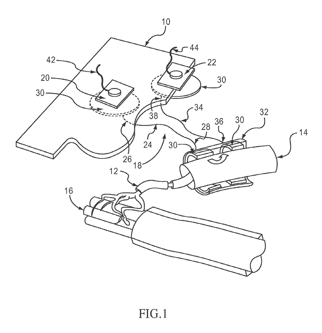 Treatment of indications using electrical stimulation