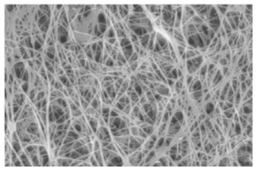 Collagen/bacterial cellulose composite membrane dressing and preparation method thereof