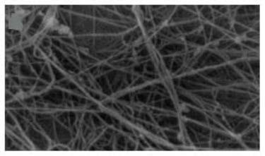 Collagen/bacterial cellulose composite membrane dressing and preparation method thereof