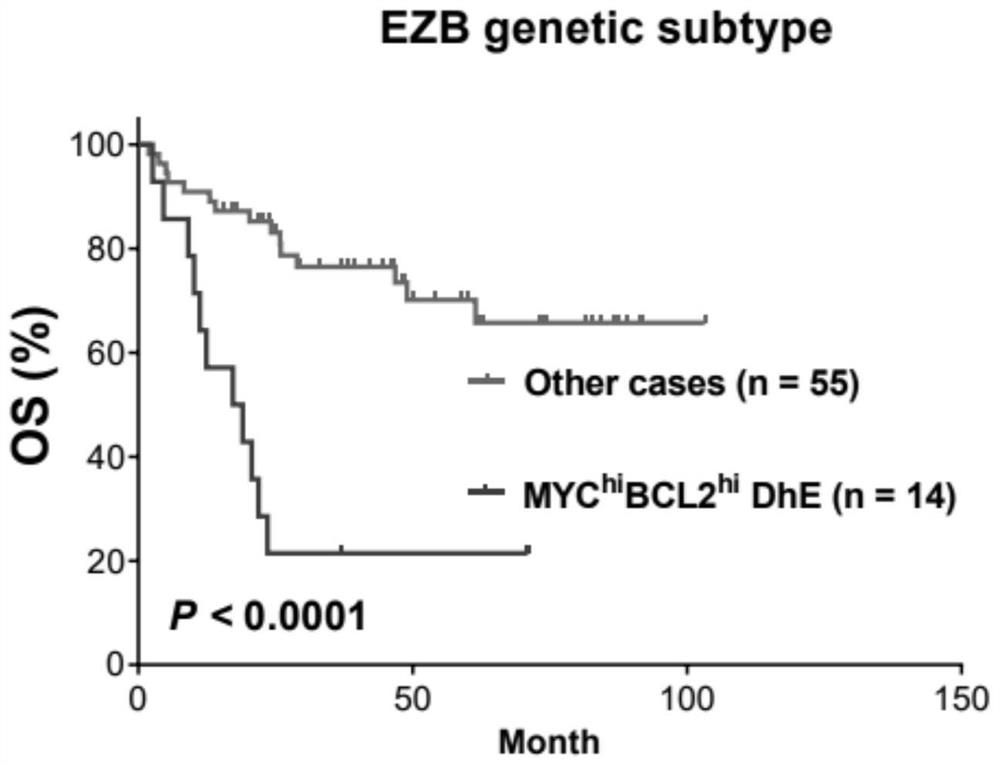 Diffuse large B-cell lymphoma prognosis model based on MYC/BCL2 double expression and immune microenvironment, application and prognosis method