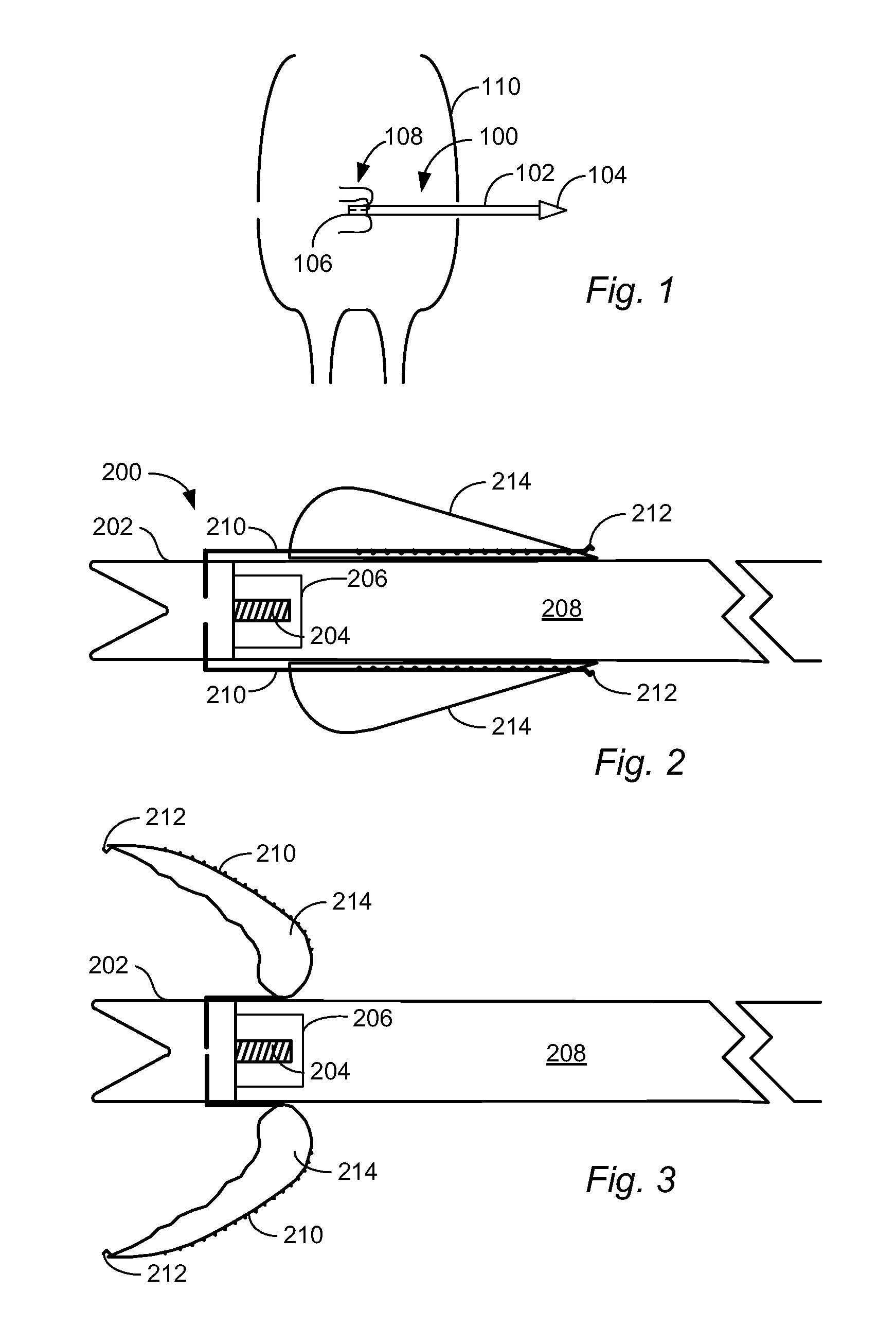 Rear mountable cutter device for a hunting arrow