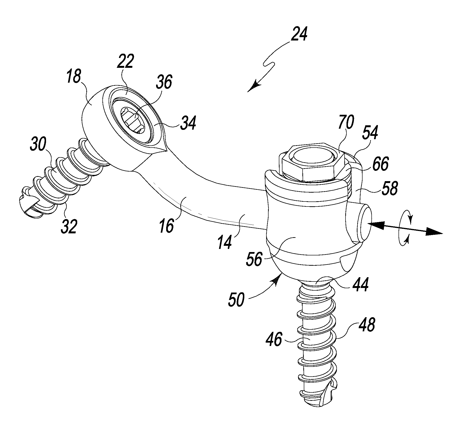 Laminoplasty Rod System