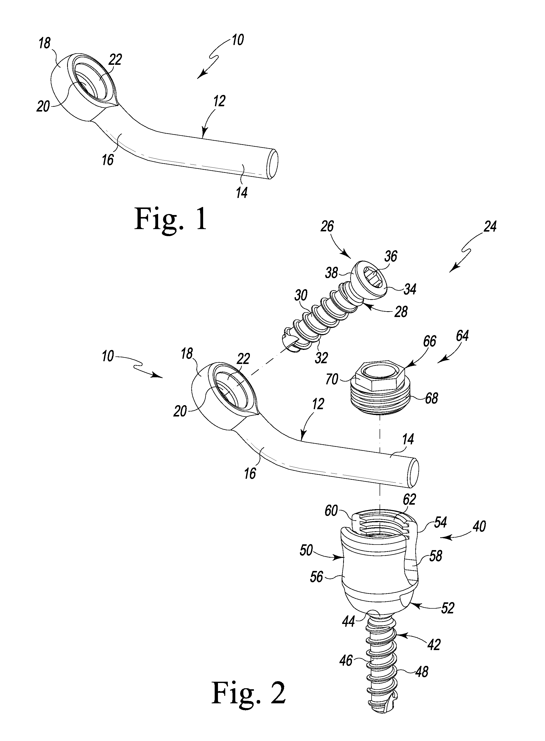 Laminoplasty Rod System