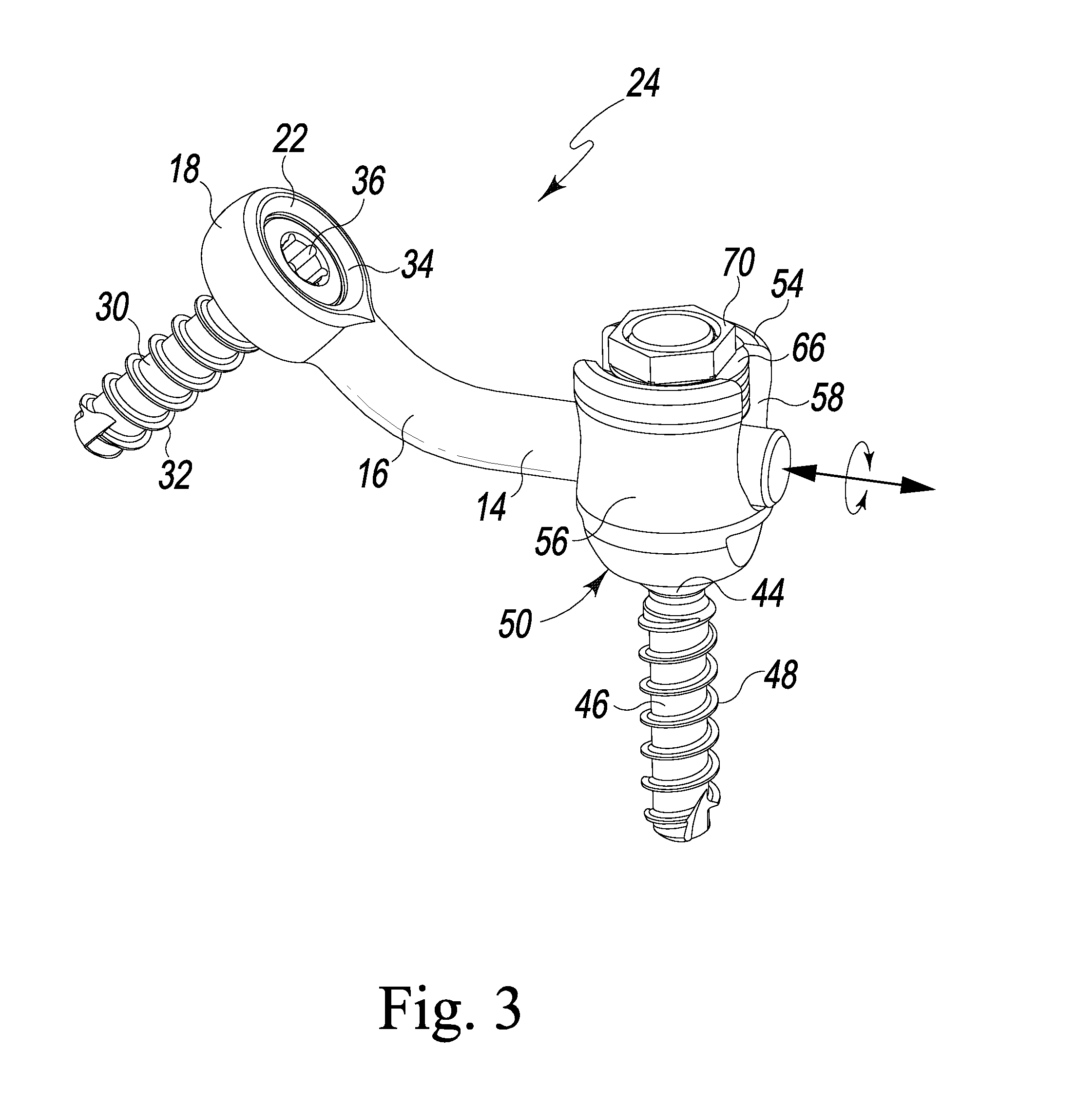 Laminoplasty Rod System