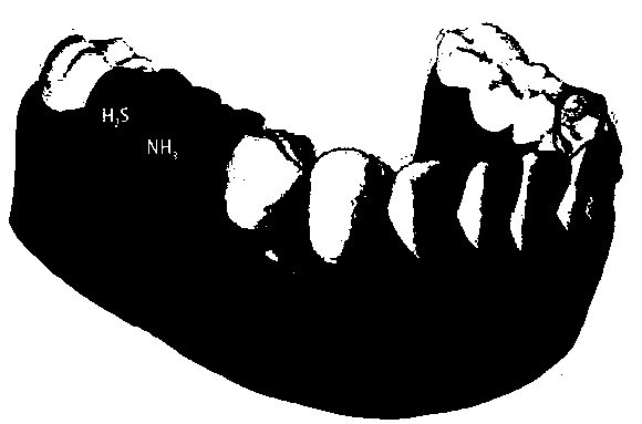 Tooth socket for detecting tooth diseases