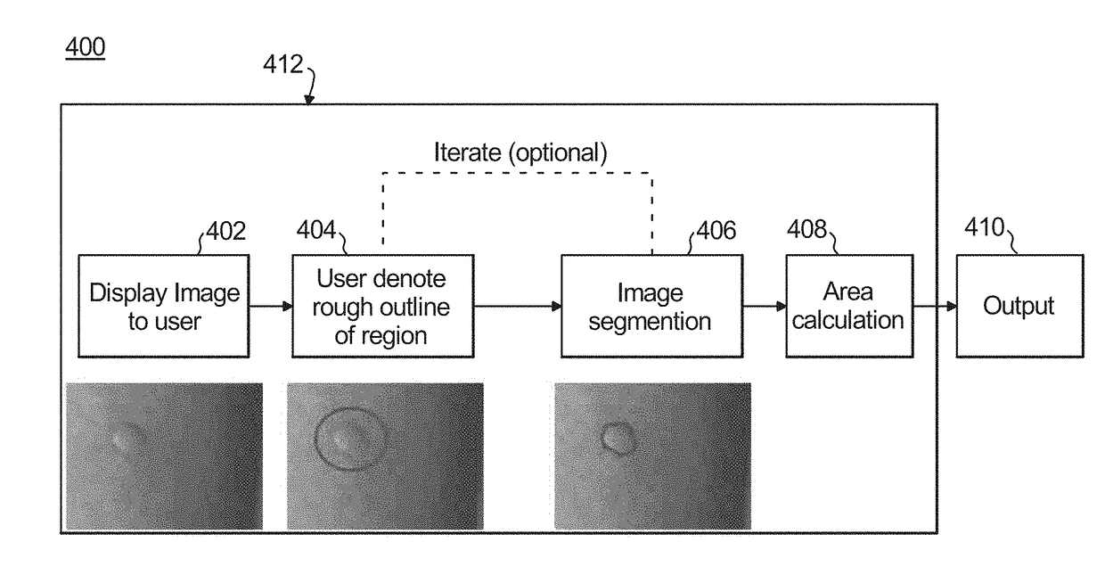 Systems and methods for image-based quantification for allergen skin reaction